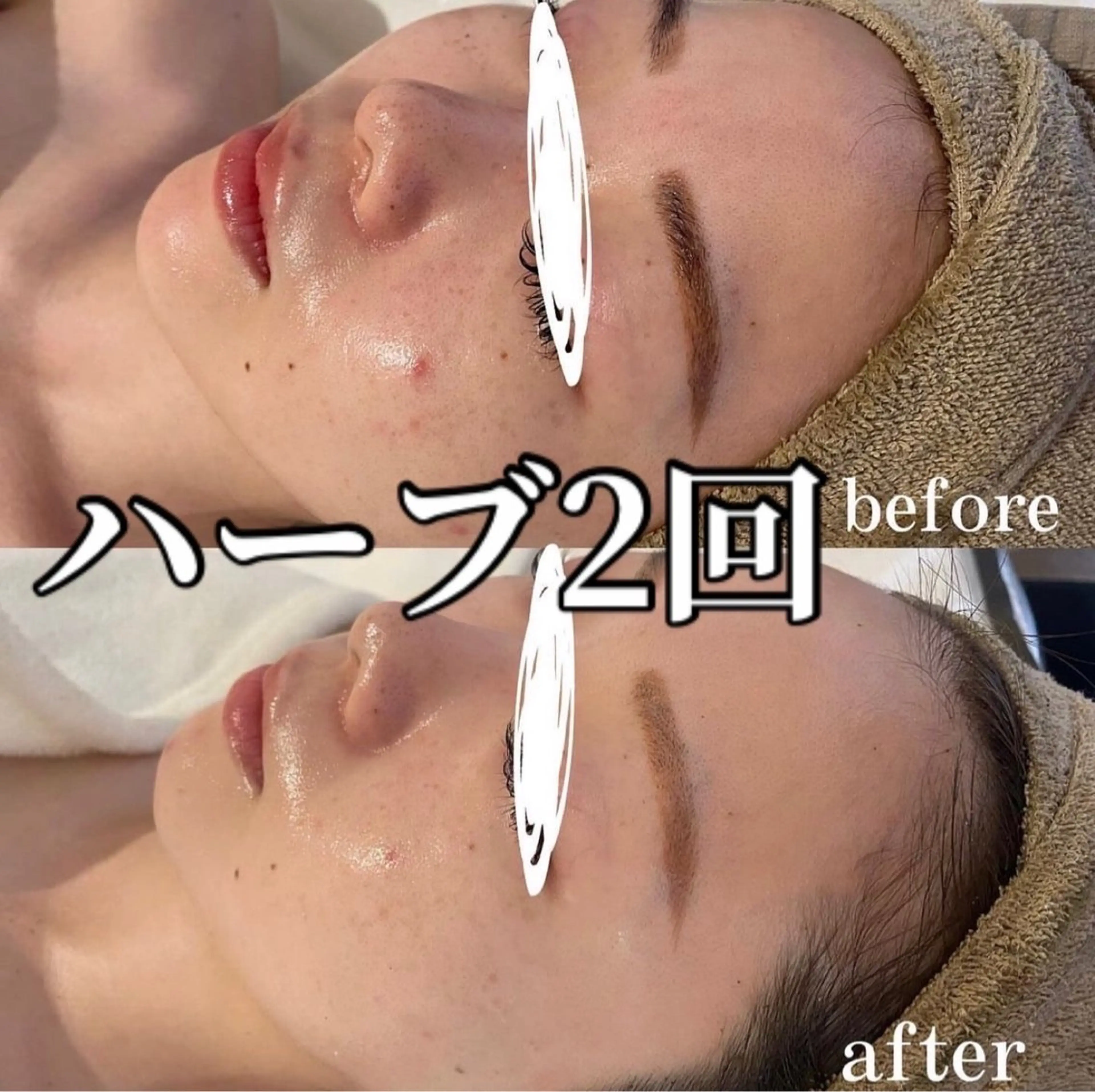 中目黒ハーブピーリン グ🌿ララピールのエステ・リラクイメージ