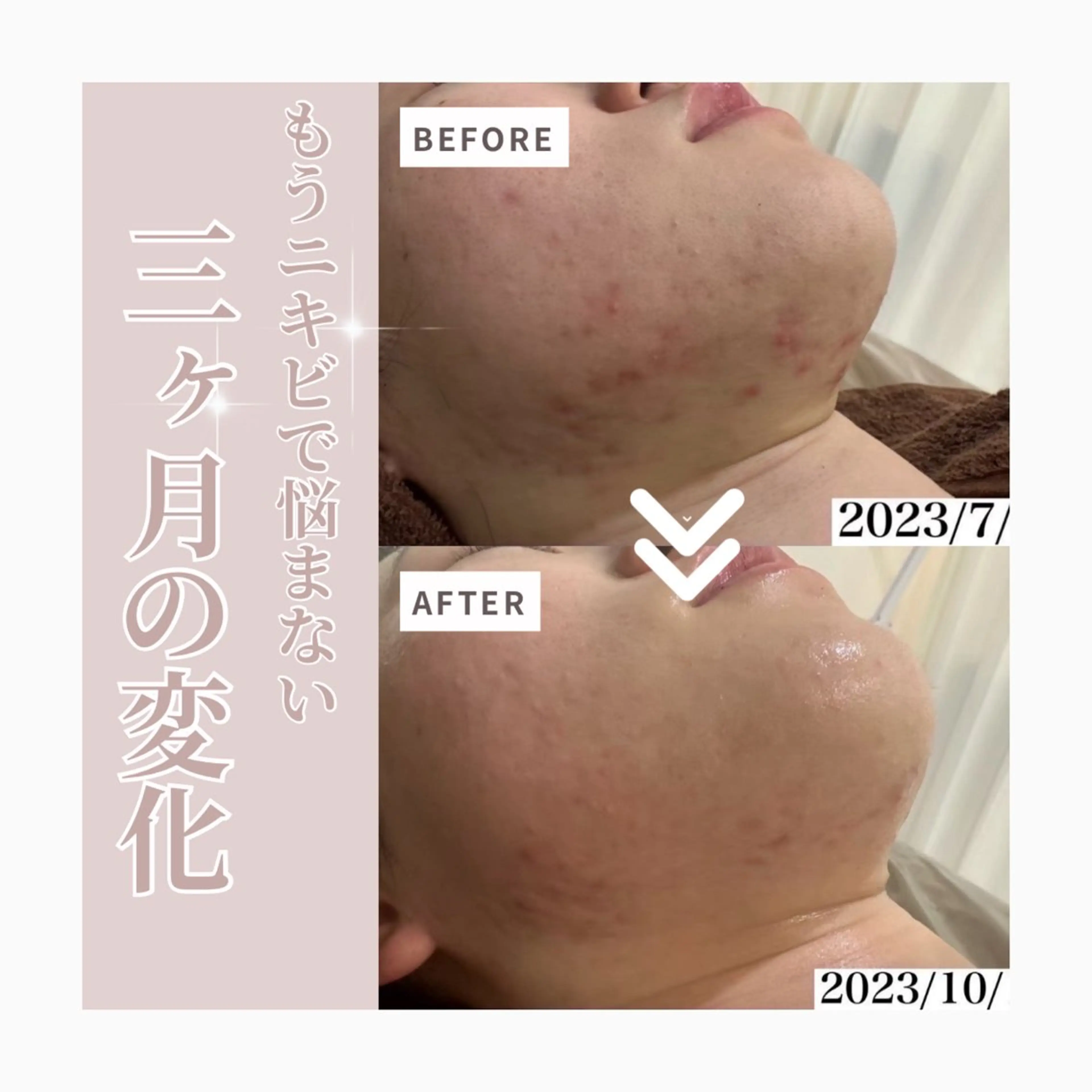 Horishia 福岡博多店のエステ・リラクイメージ