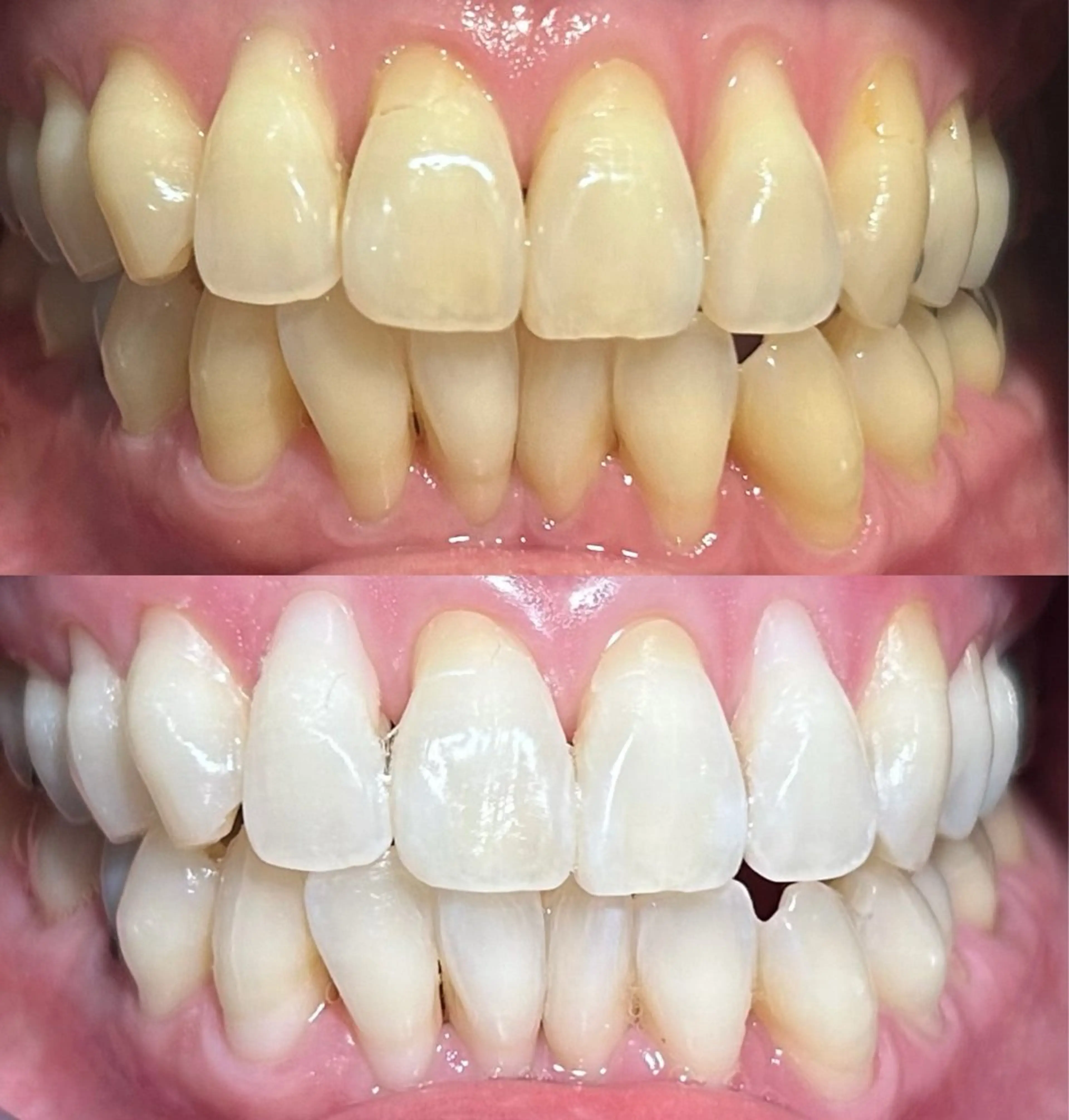 io teeth careのその他イメージ