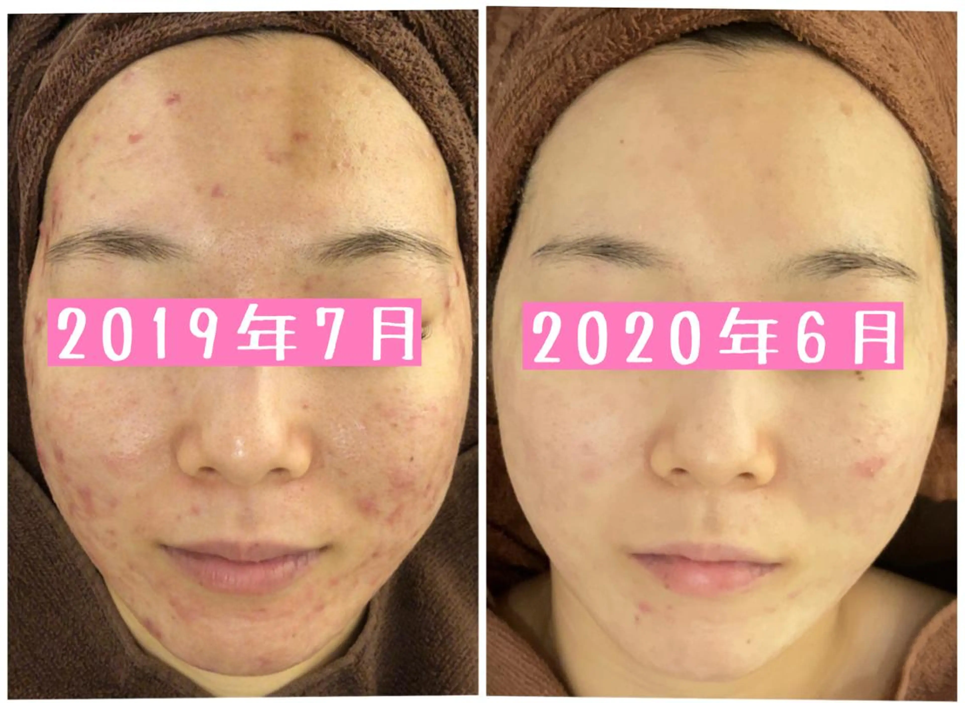 ミディアム カラー パーマ ヘアアレンジ メンズ キッズ ネイル マツエク・マツパ エステ リラク ニキビ・肌質改善専門 ♡人生が変わるサロンのエステ・リラクイメージ