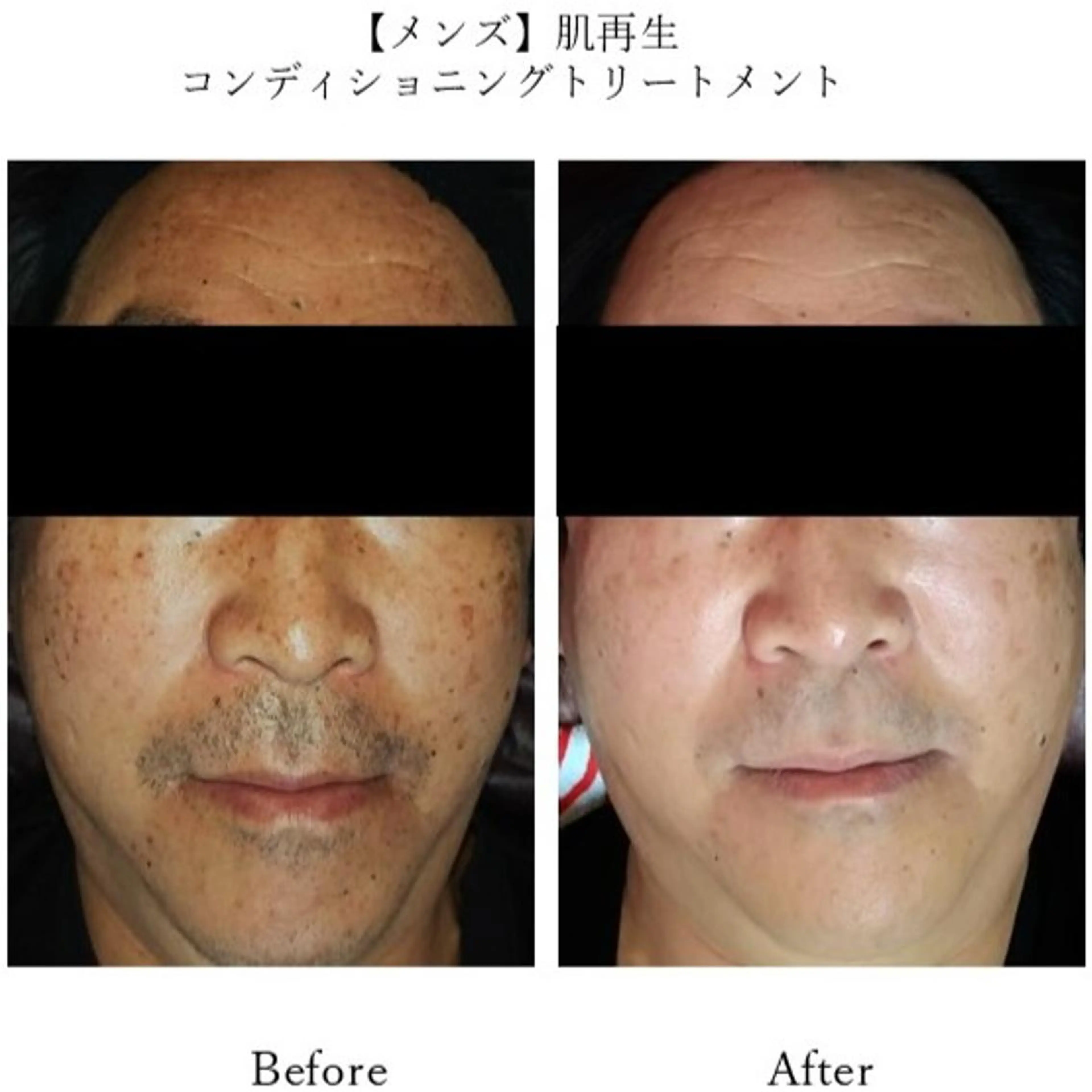 エステ ふじわら ひかりのその他イメージ