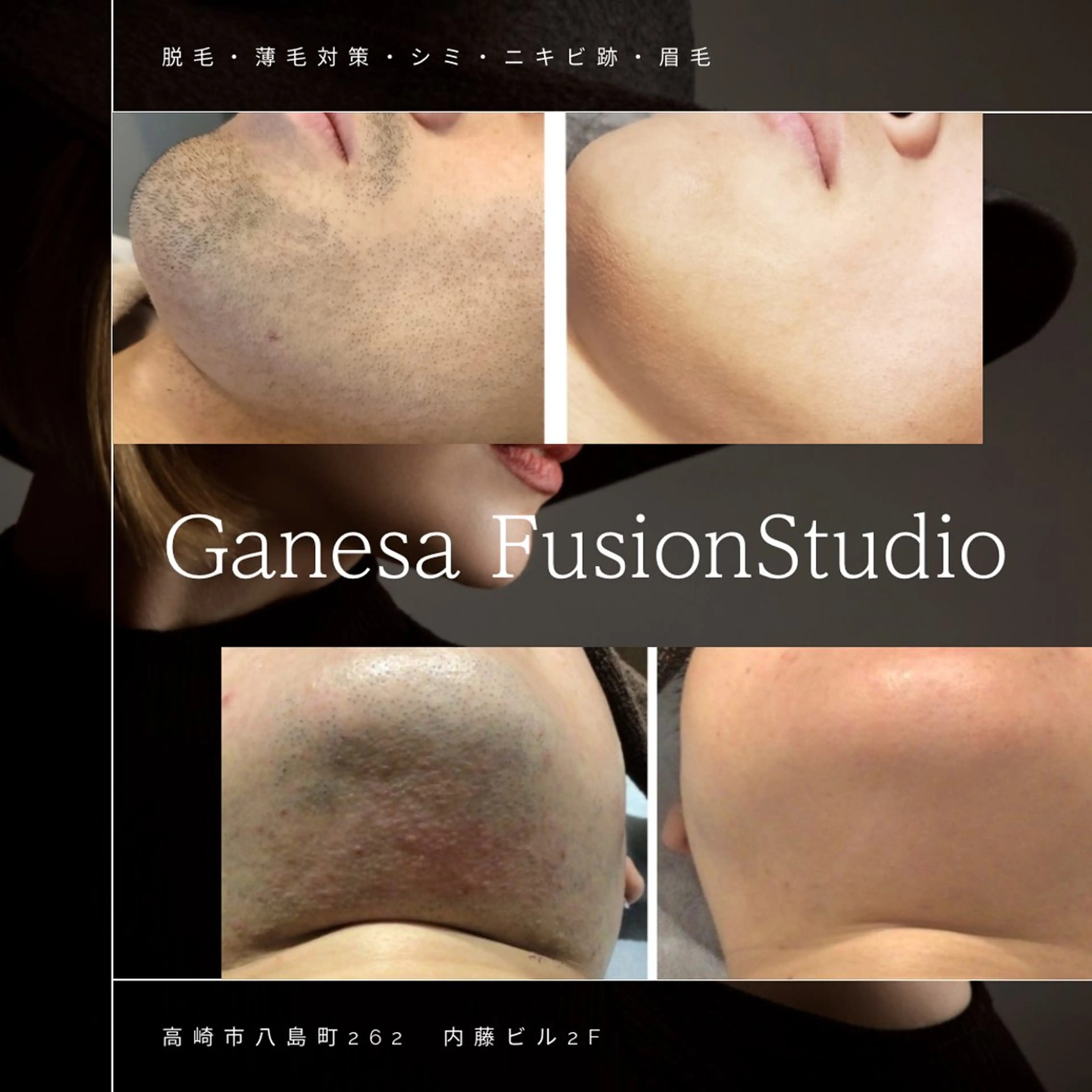 Ganesa Fusion Studio所属・井上 みあのエステ・リラクイメージ