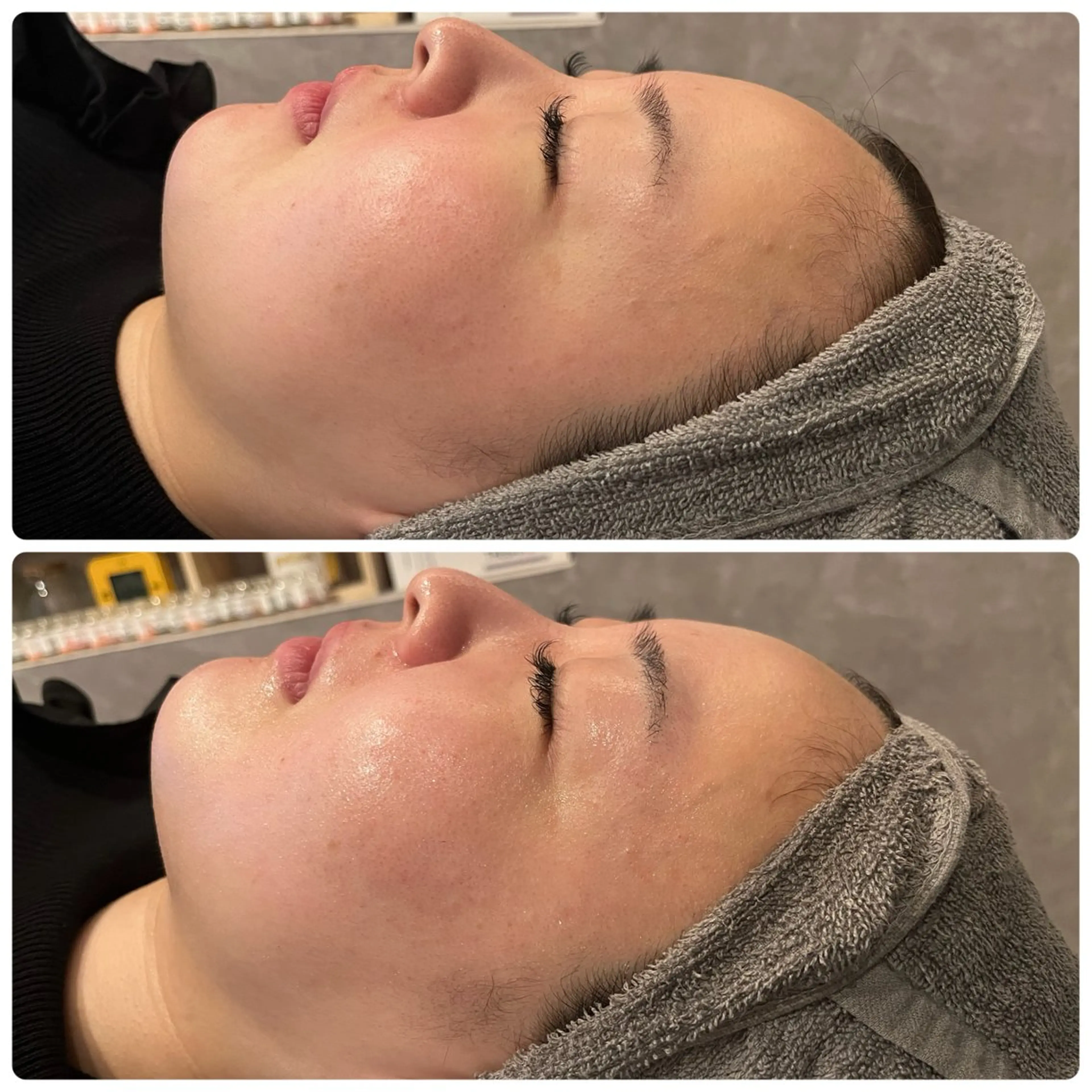 エステ yellow.所属・yellow💛【 脱毛&フェイシャル】のエステ・リラクイメージ