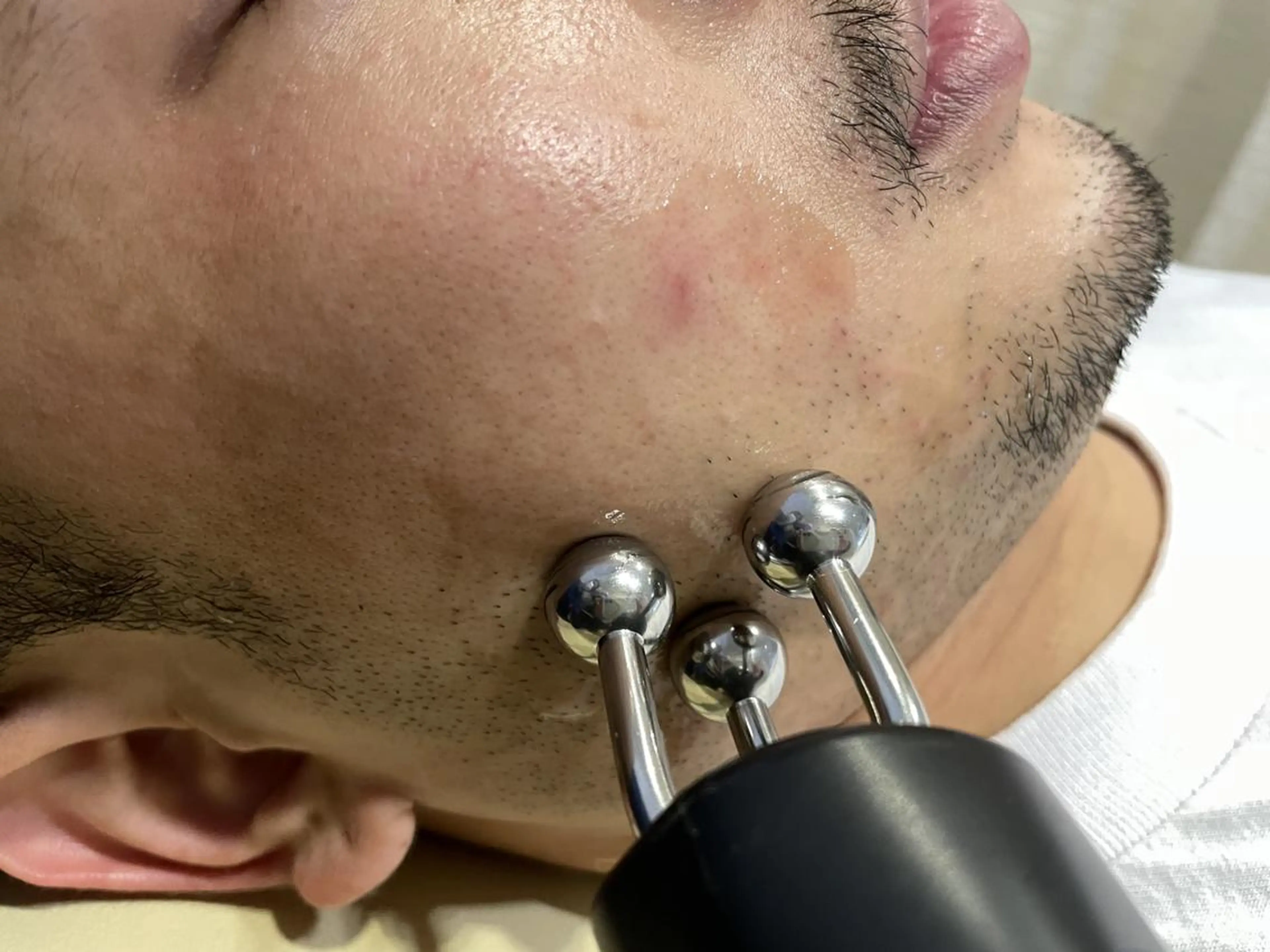 メンズ むくみたるみ専門☆ 美容鍼・小顔矯正のエステ・リラクイメージ