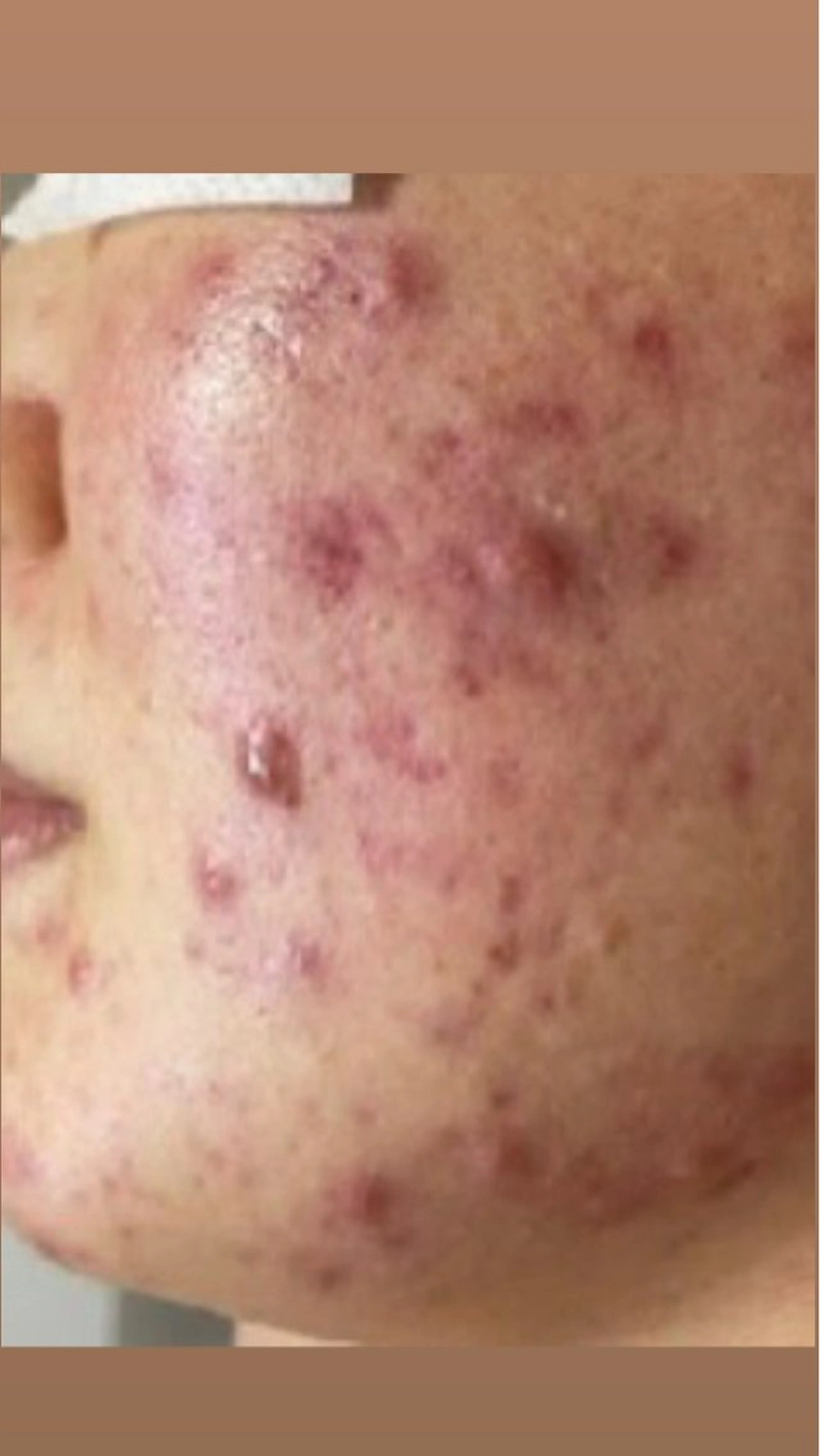 エステ 韓国🇰🇷価格 サロン_Nbibiのエステ・リラクイメージ