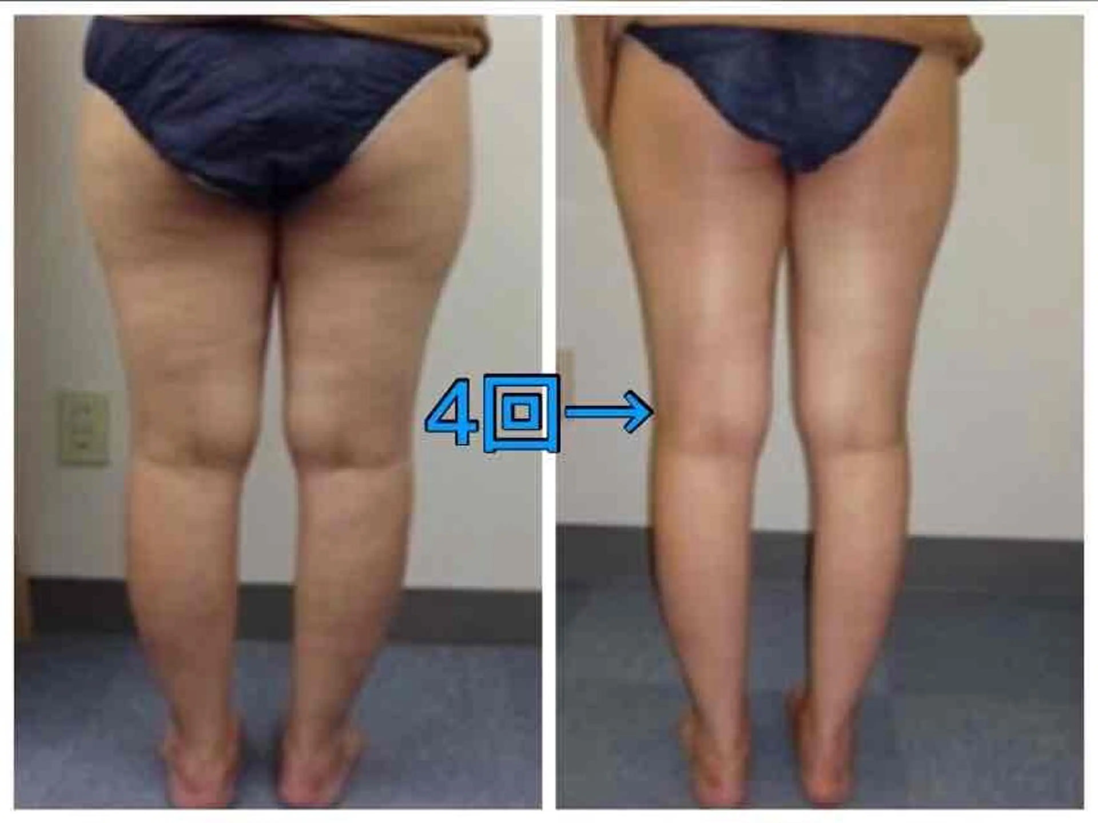 痩身·ハイパーナイフ ヘッドスパ·アロマのエステ・リラクイメージ