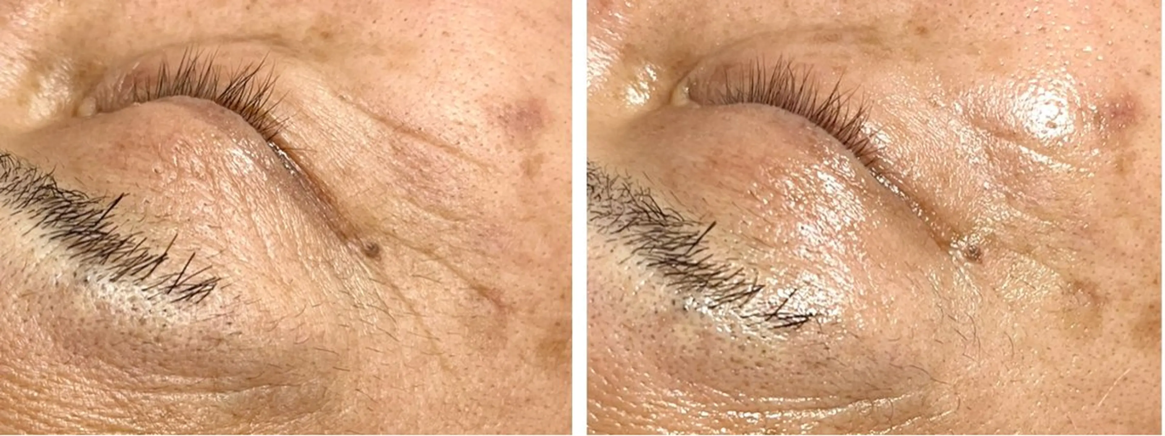 B.glossy所属・ビューティーサロン B.glossyのネイルデザイン