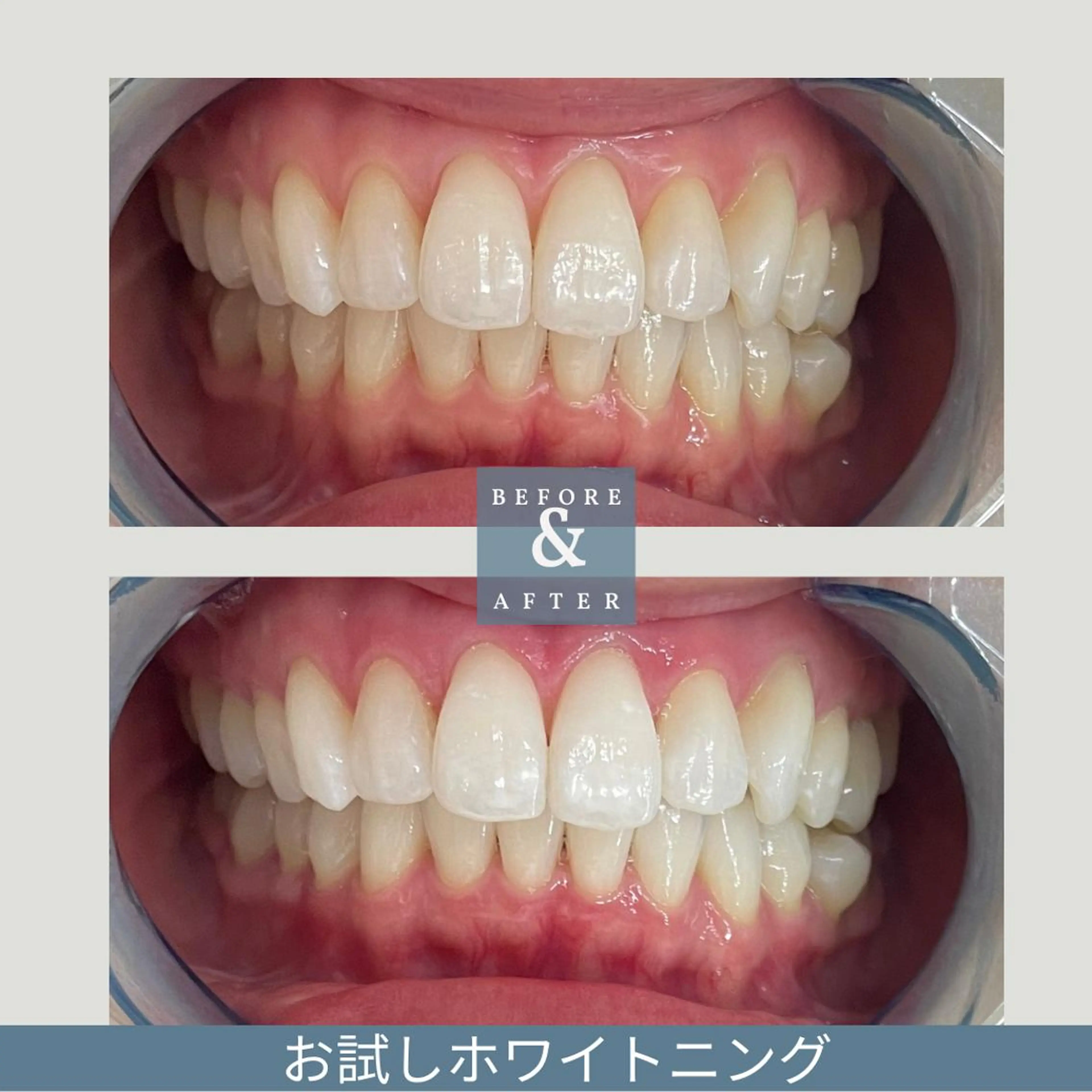 EMINAL恵比寿 HITOMIのエステ・リラクイメージ