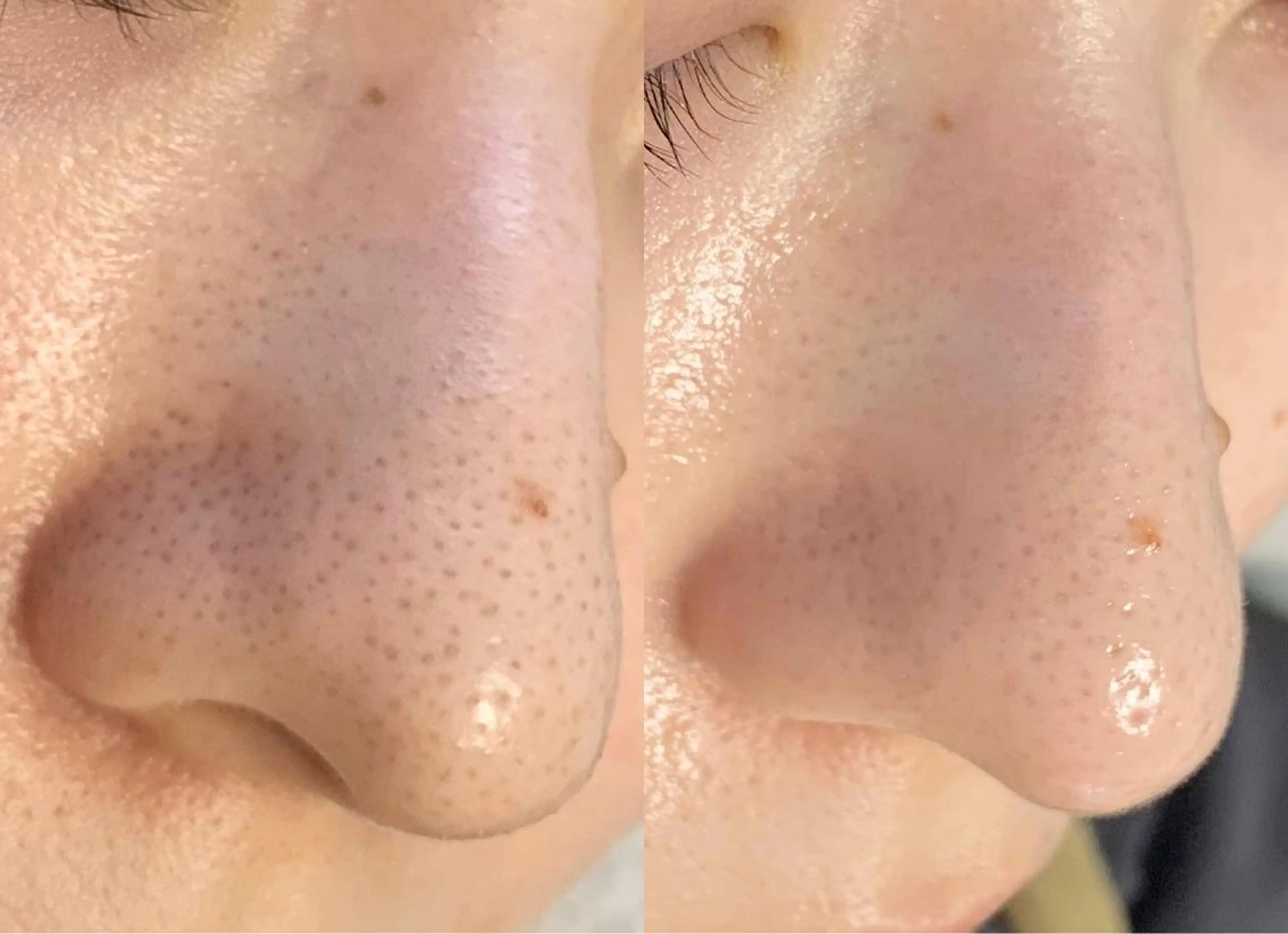 メンズ salonLADYSTYLE所属・稲嶺 美華のエステ・リラクイメージ