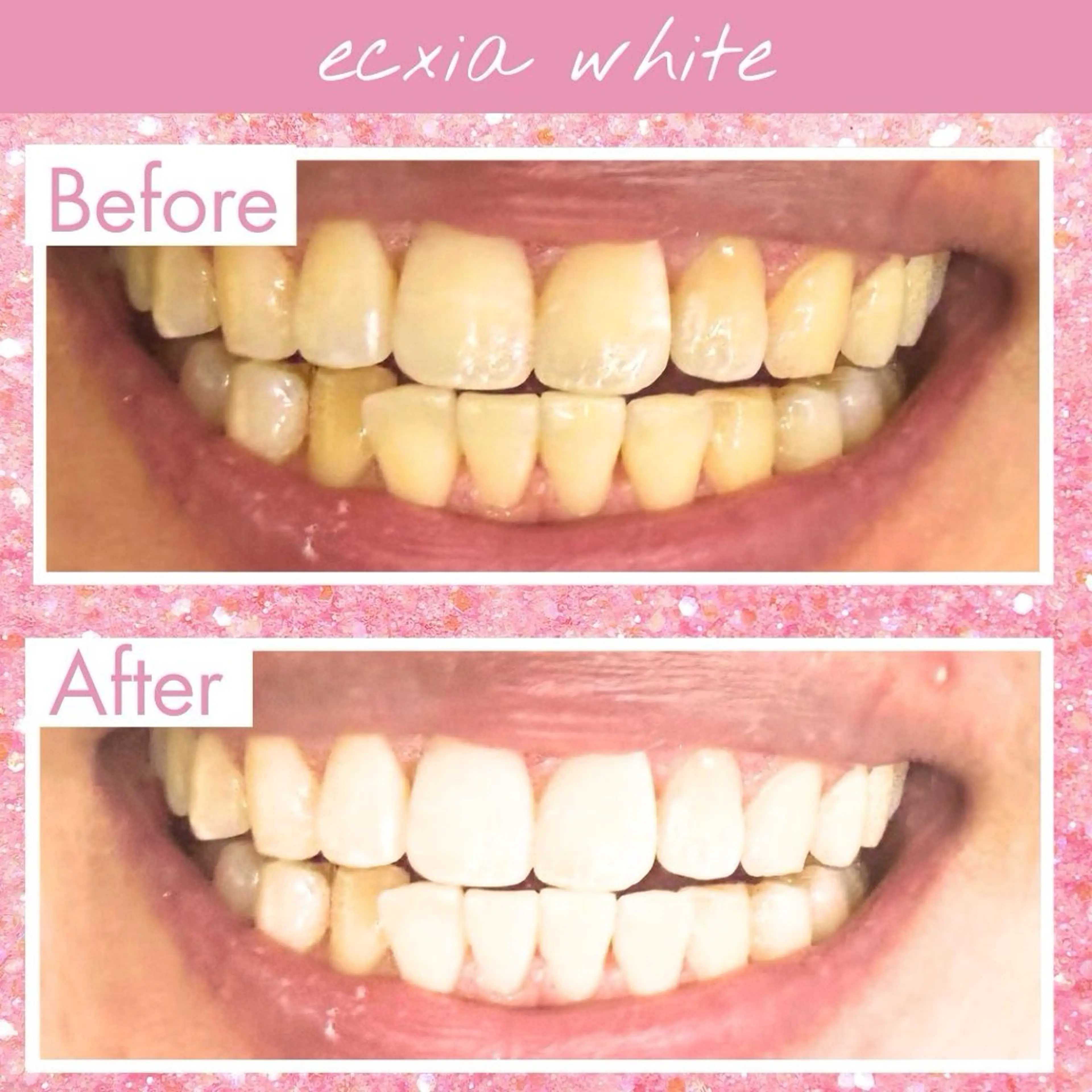 その他 セルフホワイトニング エクシア大府店のその他イメージ