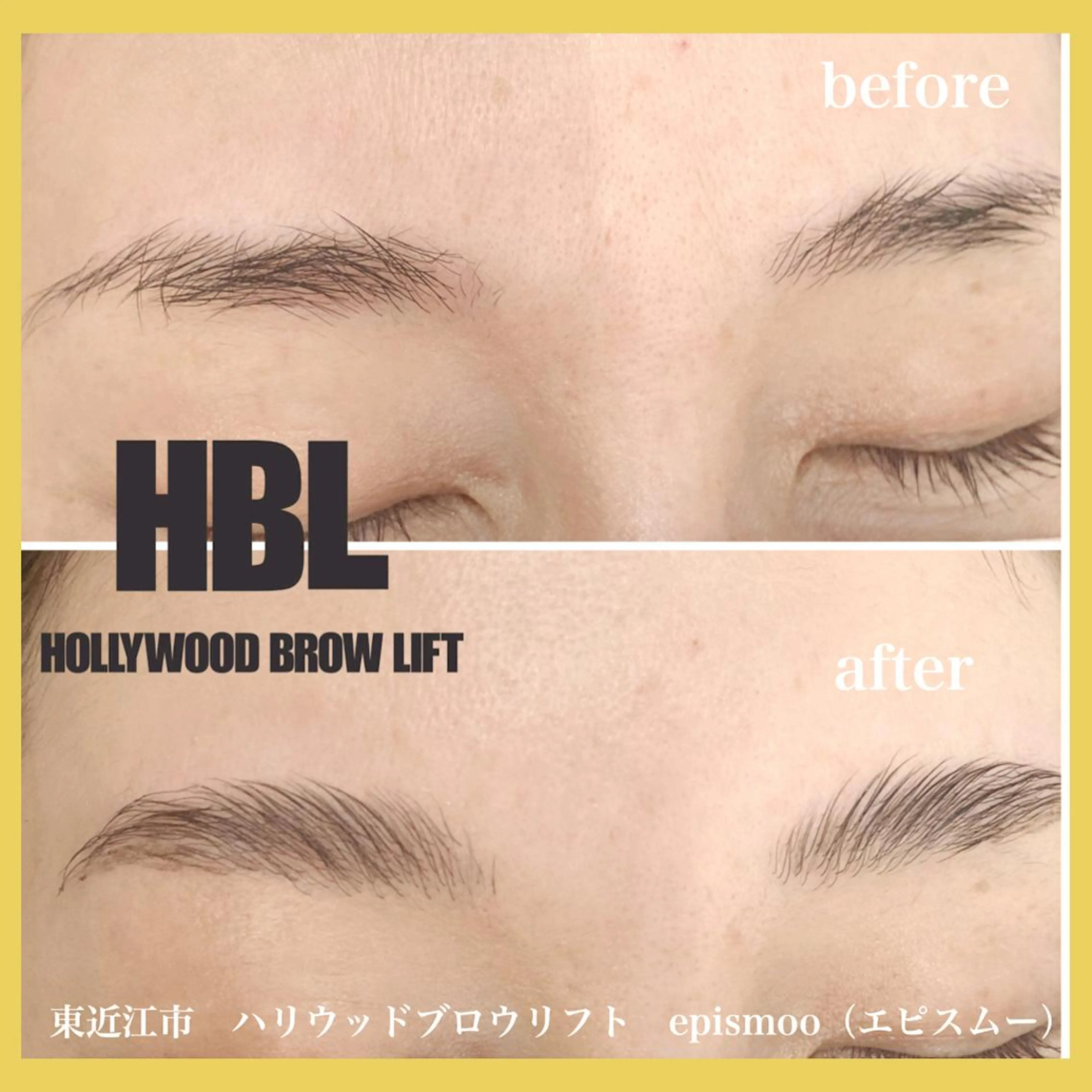 アイブロウ epismoo 脱毛/HBL/毛穴の眉毛・アイブロウイメージ