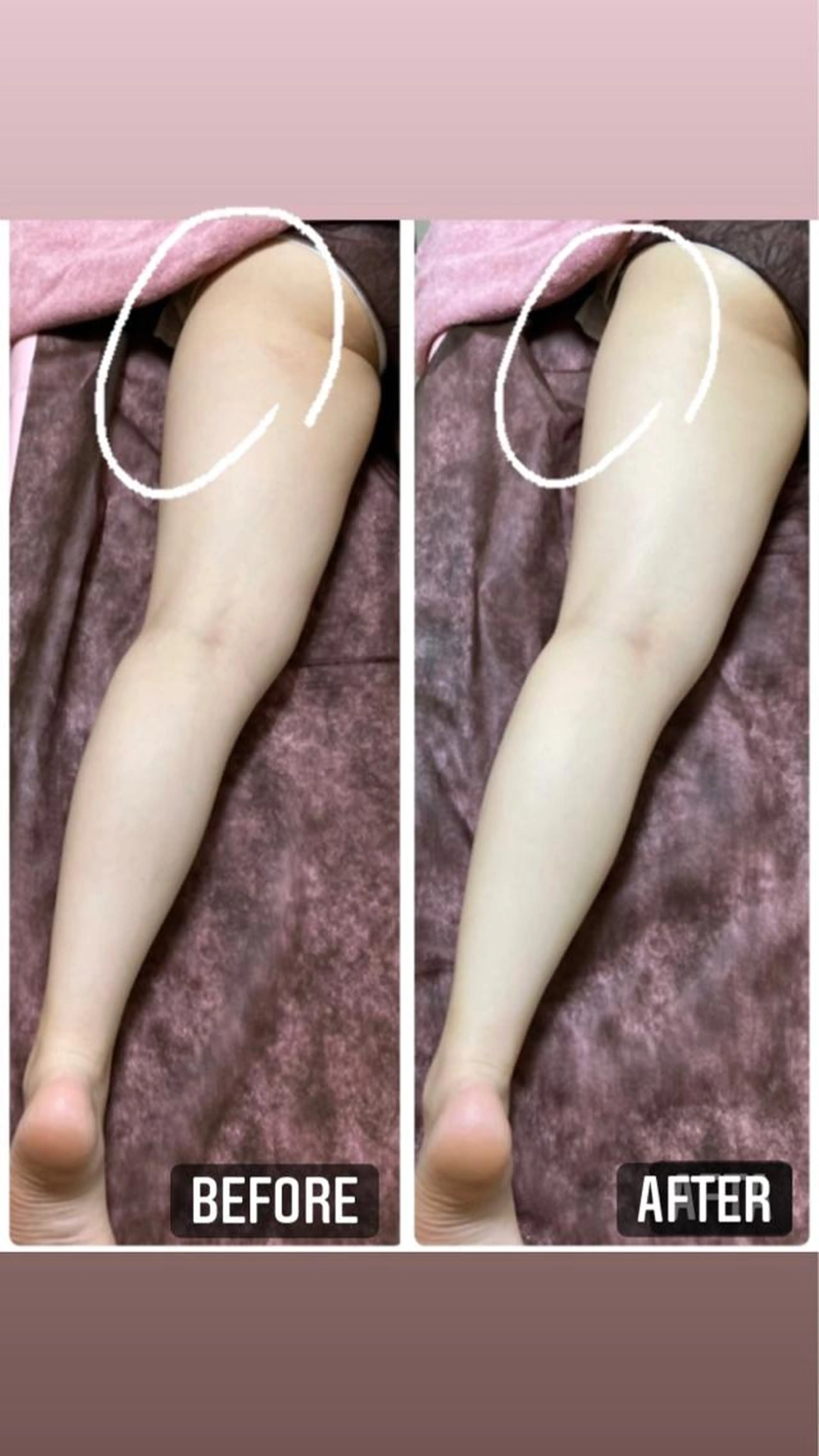 最新のシェイプアップマシンでボディ引き締め‼︎【BODY HI-FU】の写真