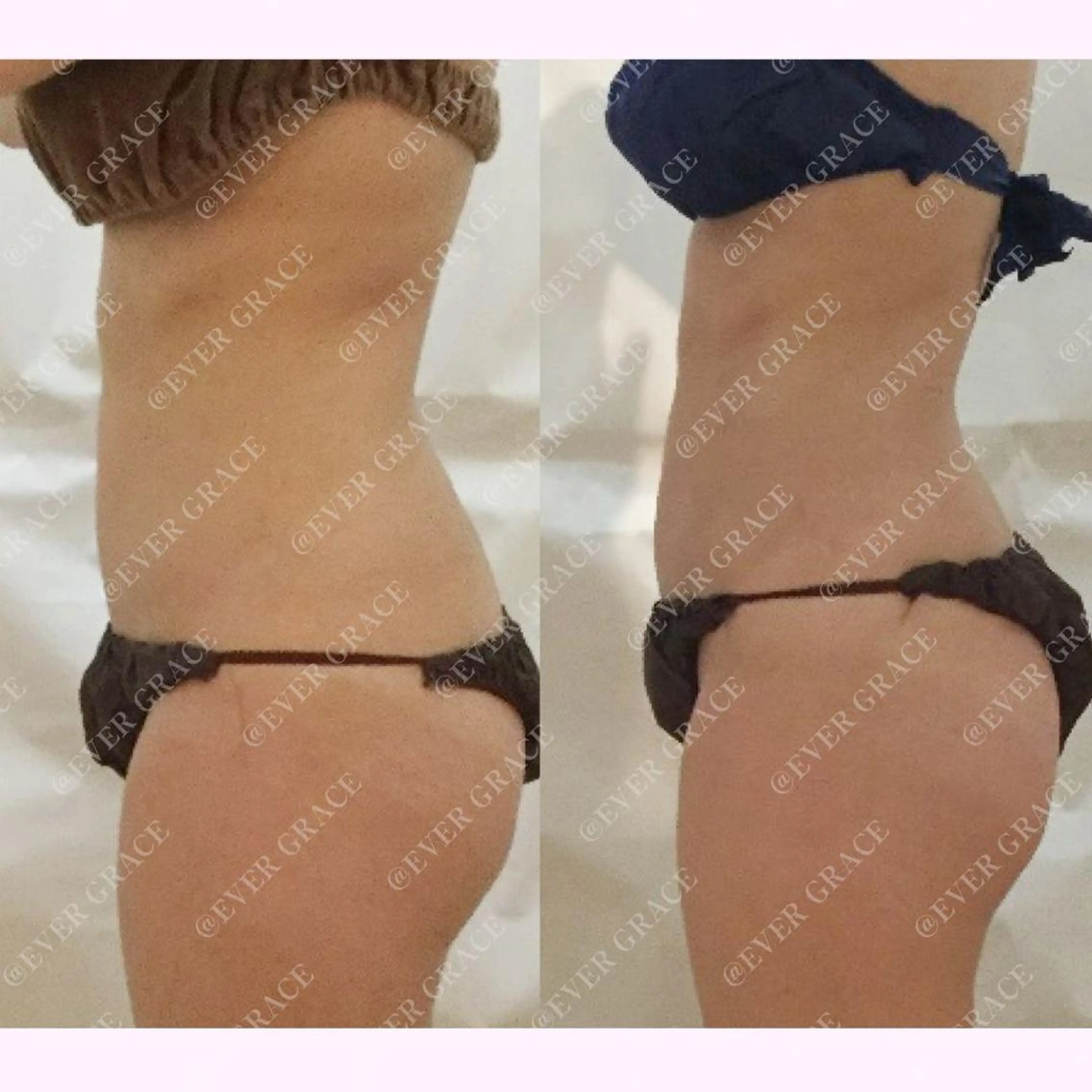 エヴァーグレース 栄店のエステ・リラクイメージ