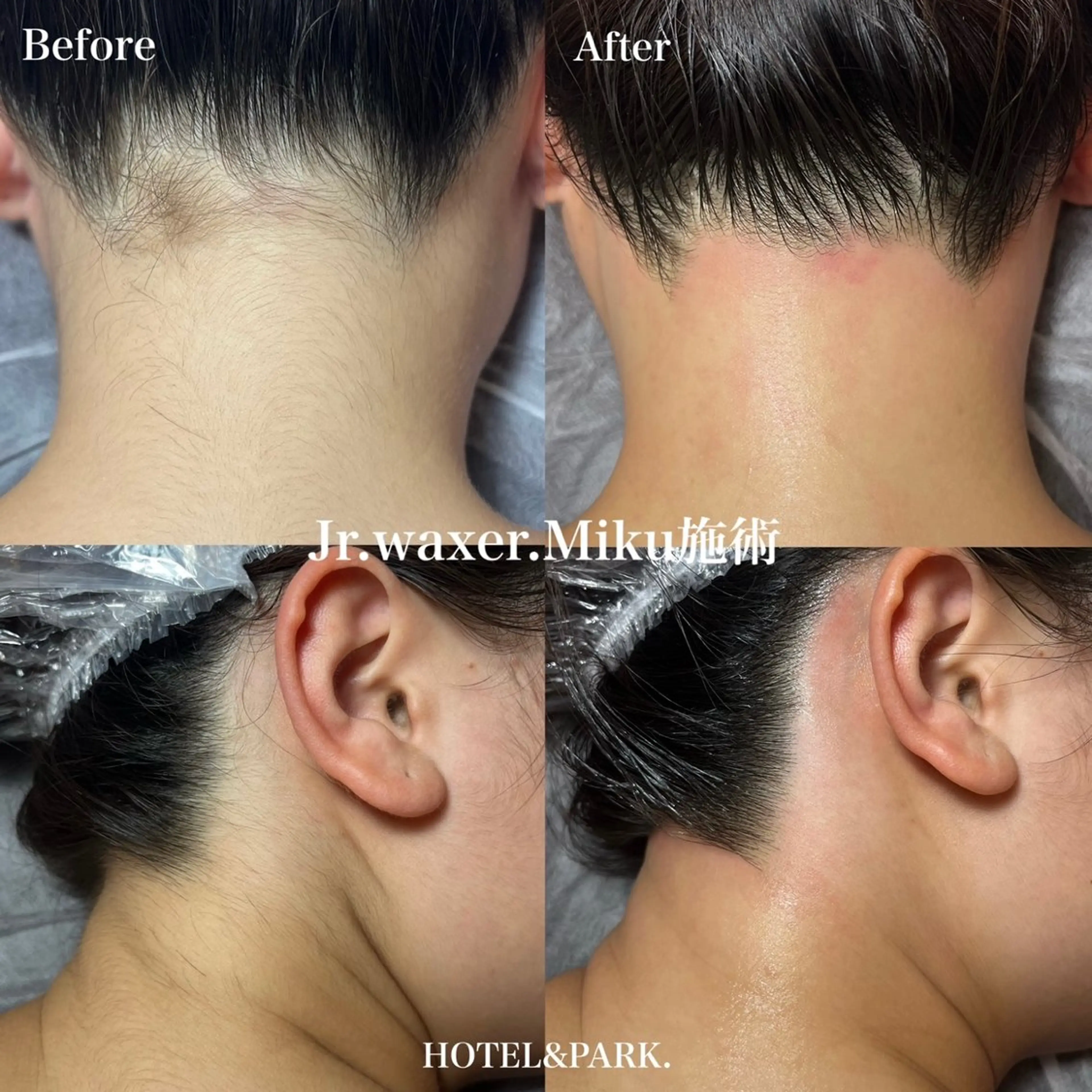 脱毛 HOTEL&PARK Mikuワックス脱毛のエステ・リラクイメージ