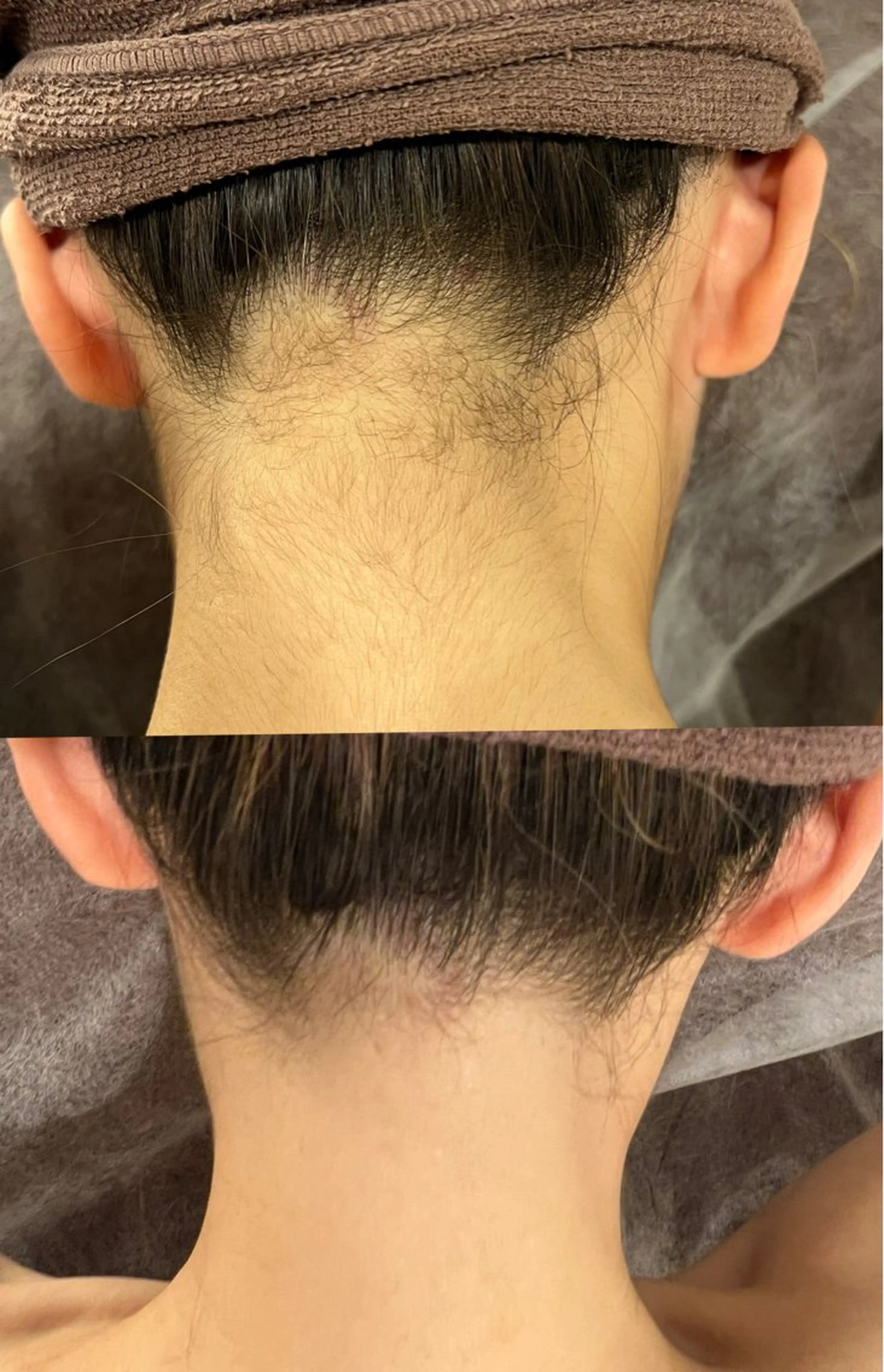 脱毛専門サロンElixir所属・脱毛専門サロン ELIXIR館林店のエステ・リラクイメージ