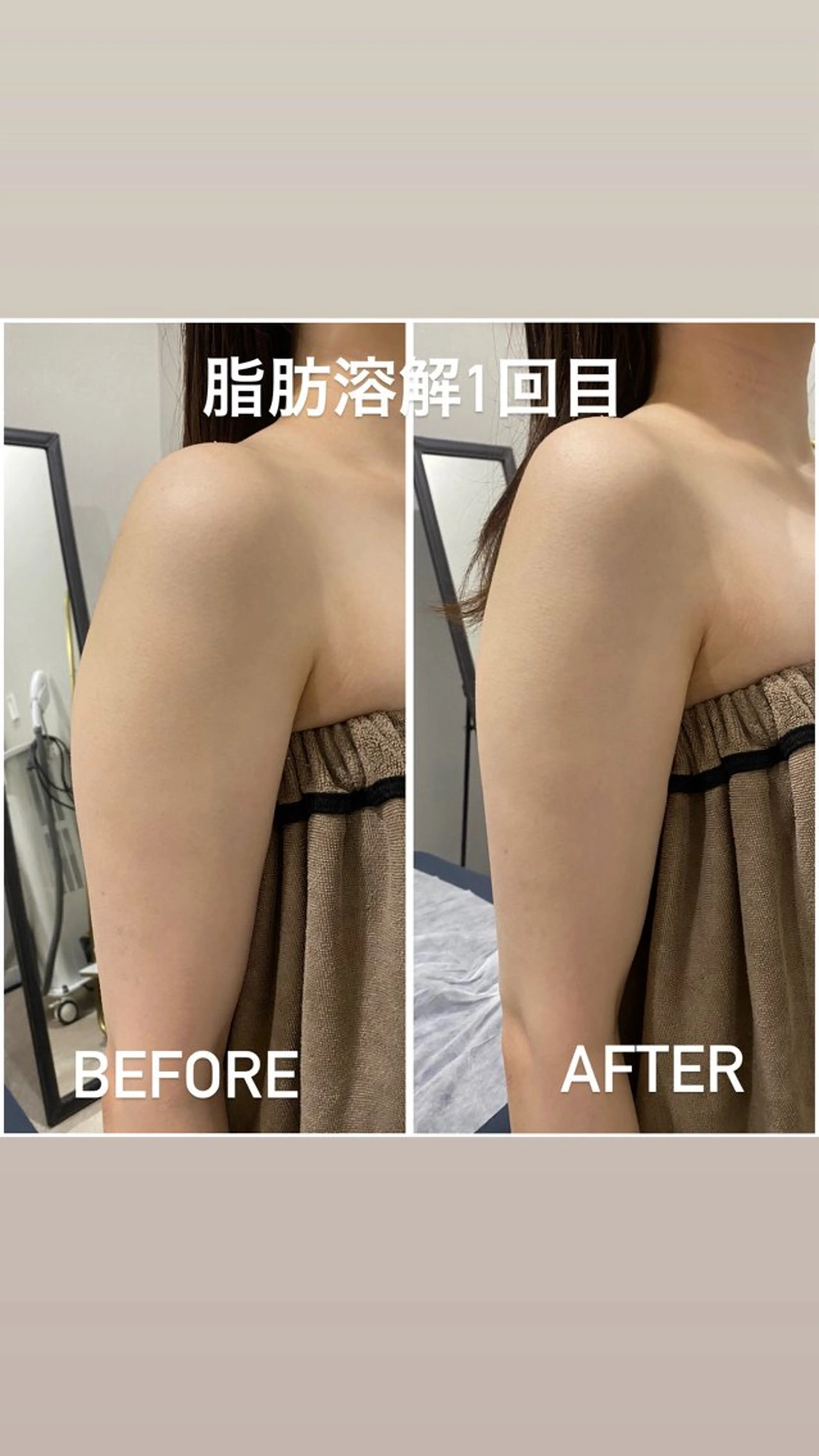 エステ 毛穴洗浄・痩身・脱毛 /アルカンジュのエステ・リラクイメージ