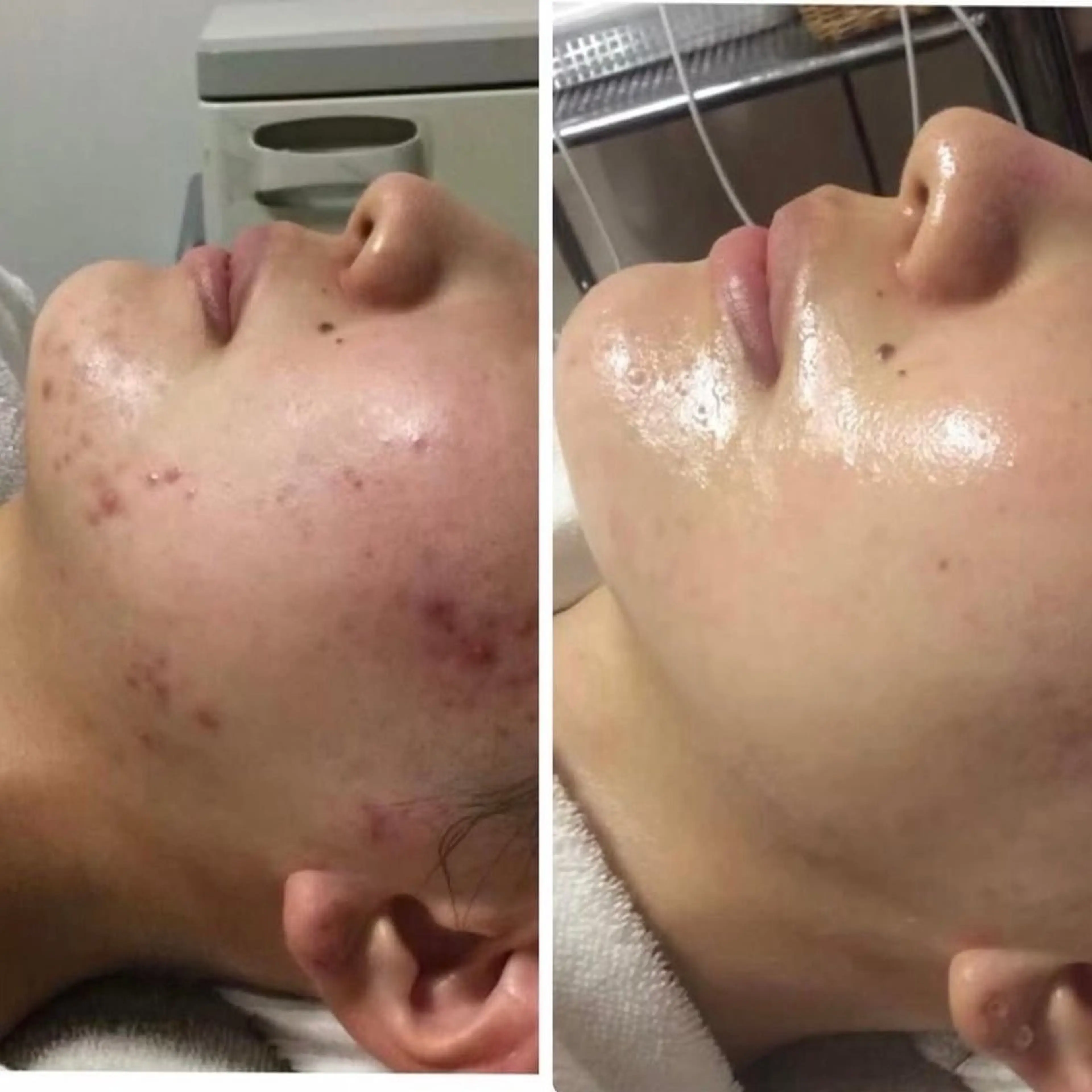 医療機関提携 ビズビズ梅田店のエステ・リラクイメージ