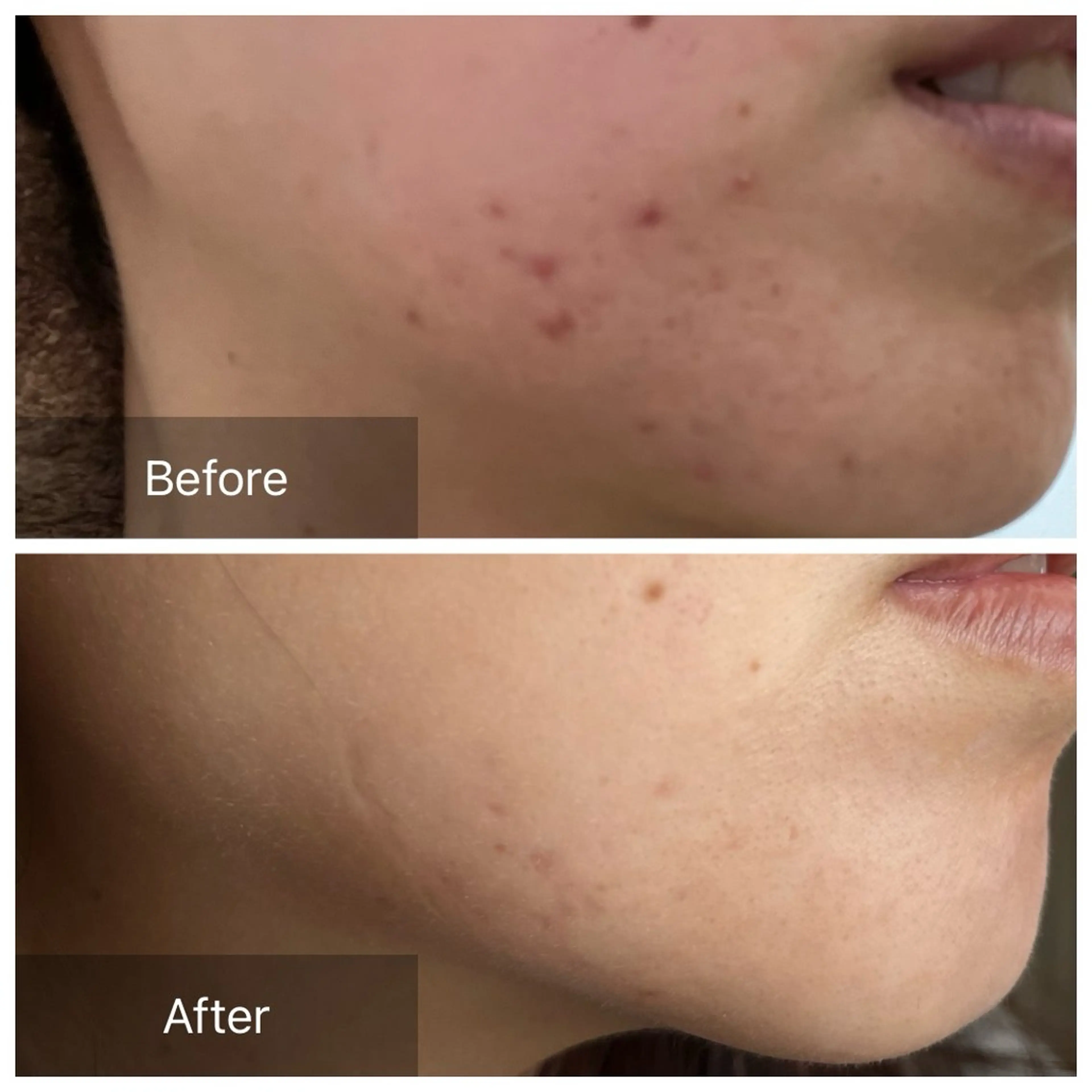 毛穴が見えなくなるサロン  Horo所属・岡 えり子のエステ・リラクイメージ