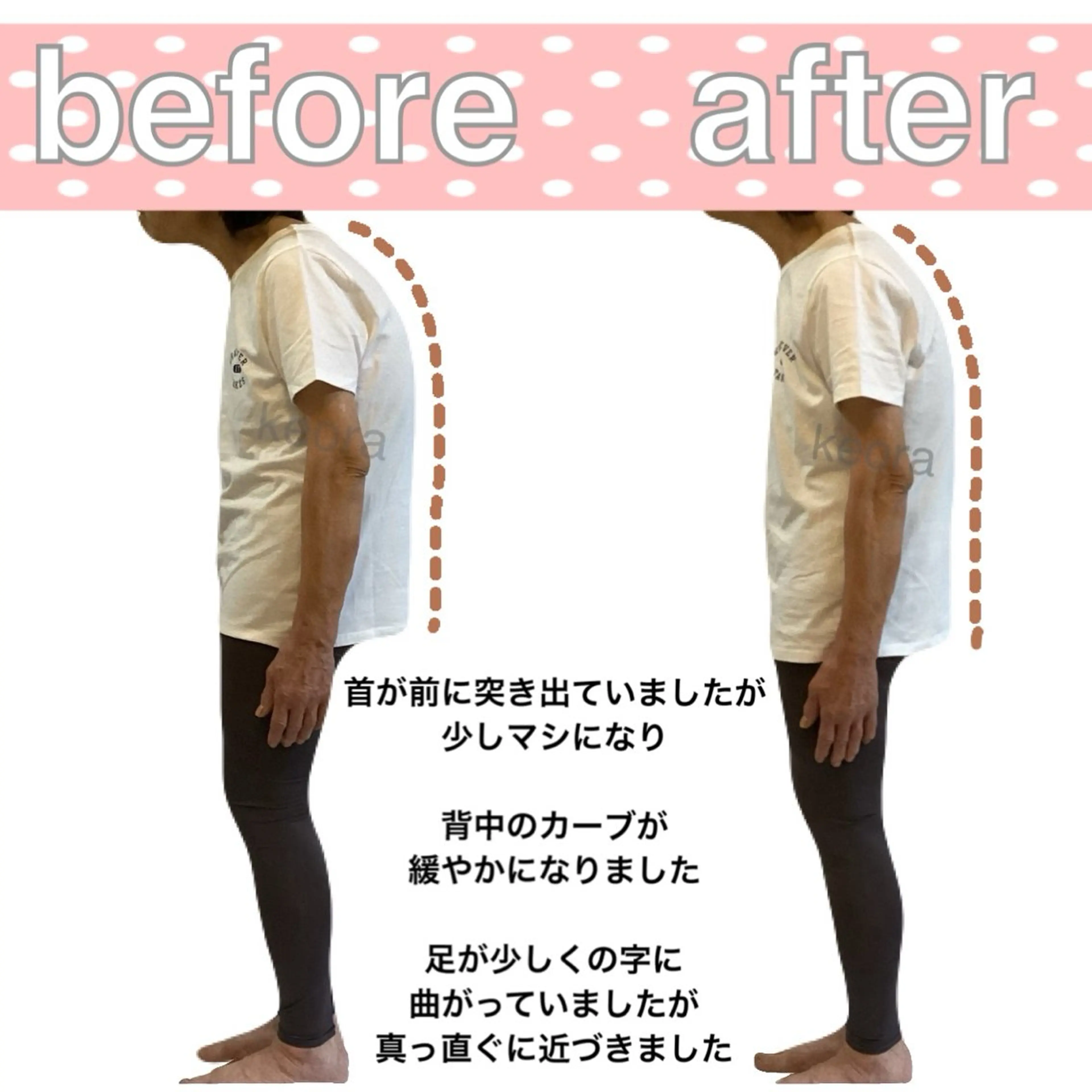 小顔矯正& 慢性肩こり腰痛改善店のエステ・リラクイメージ