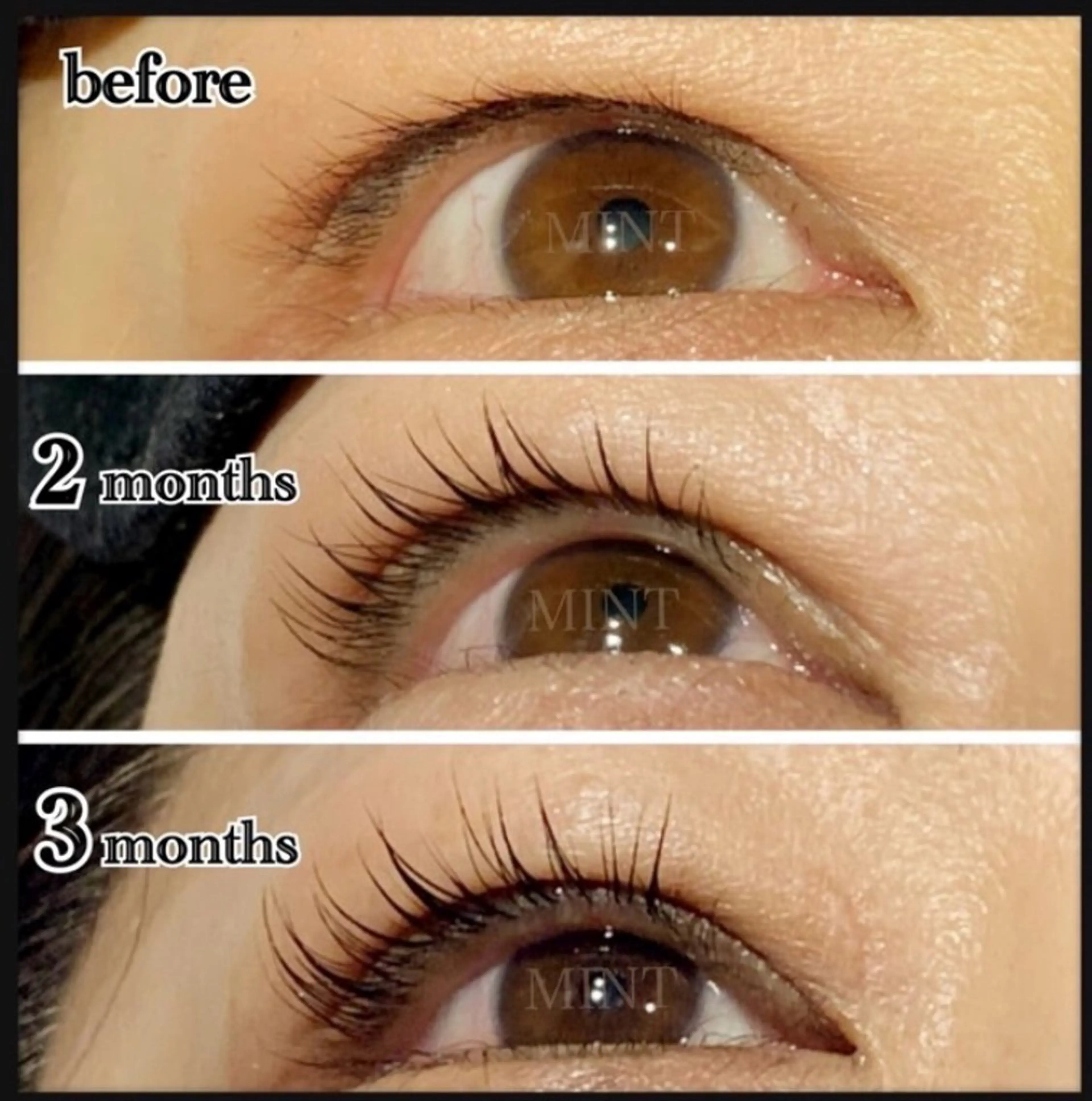 My Lamination“まつ育”ラッシュリフトの写真