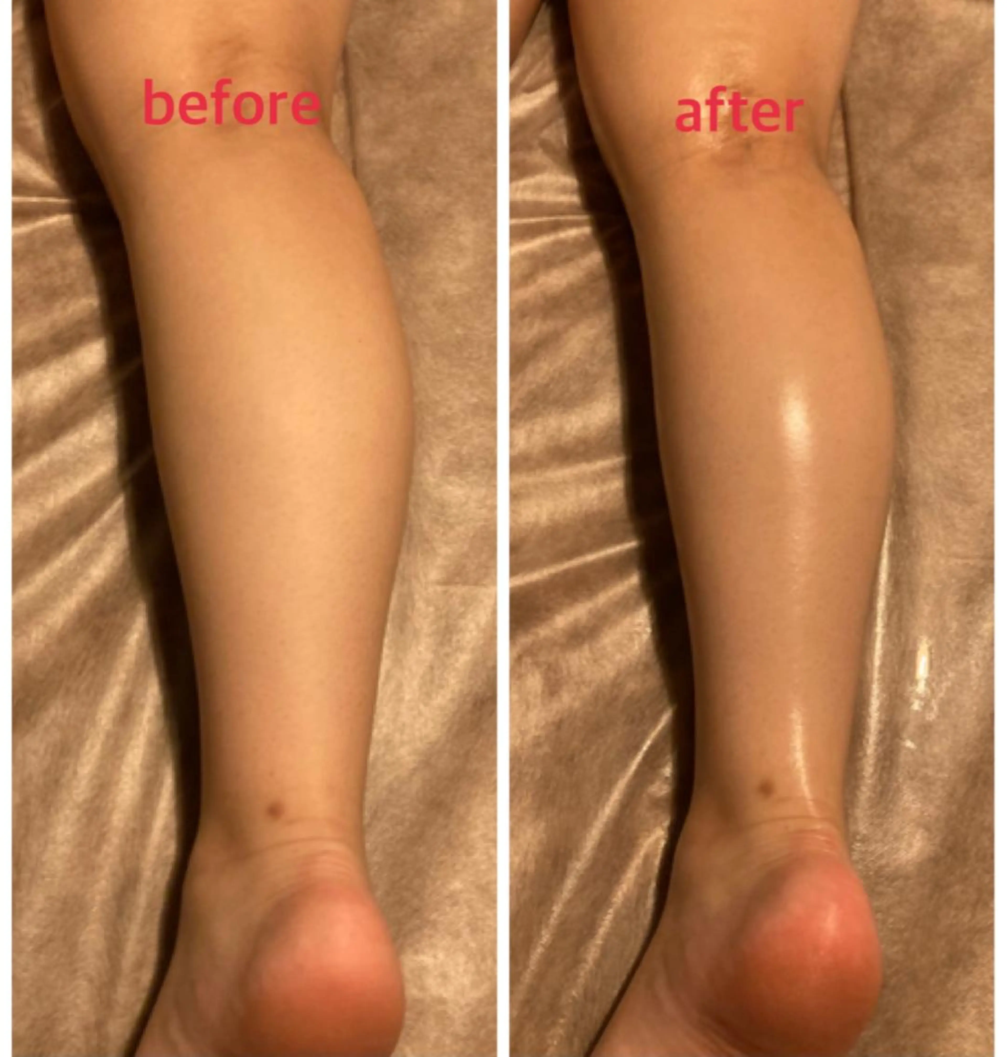 bellissimo 【ベリッシモ】所属・ちひろ　痩身/ハーブ bellissimoのエステ・リラクイメージ