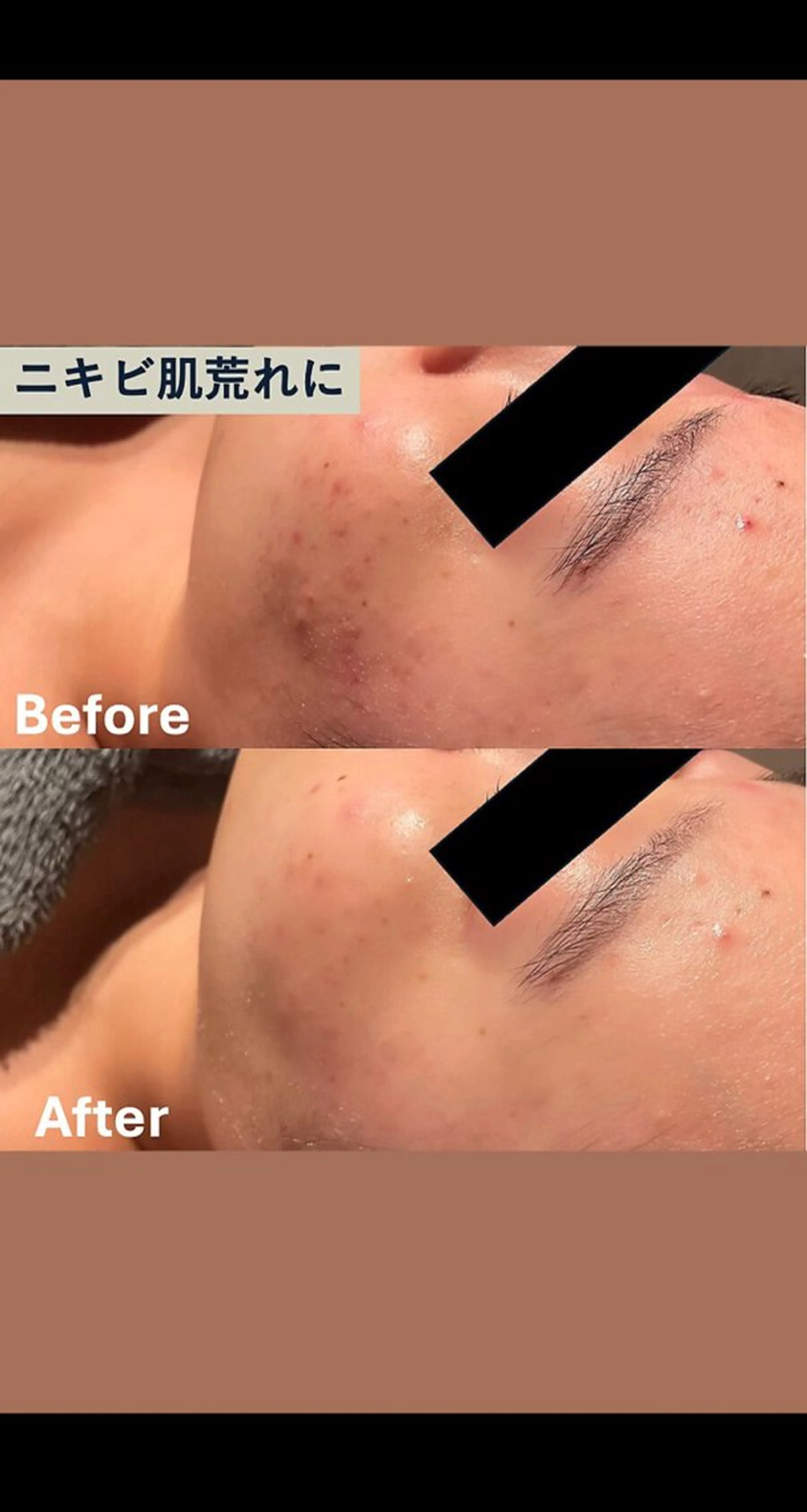 Moana【モアナ】 HIROのエステ・リラクイメージ