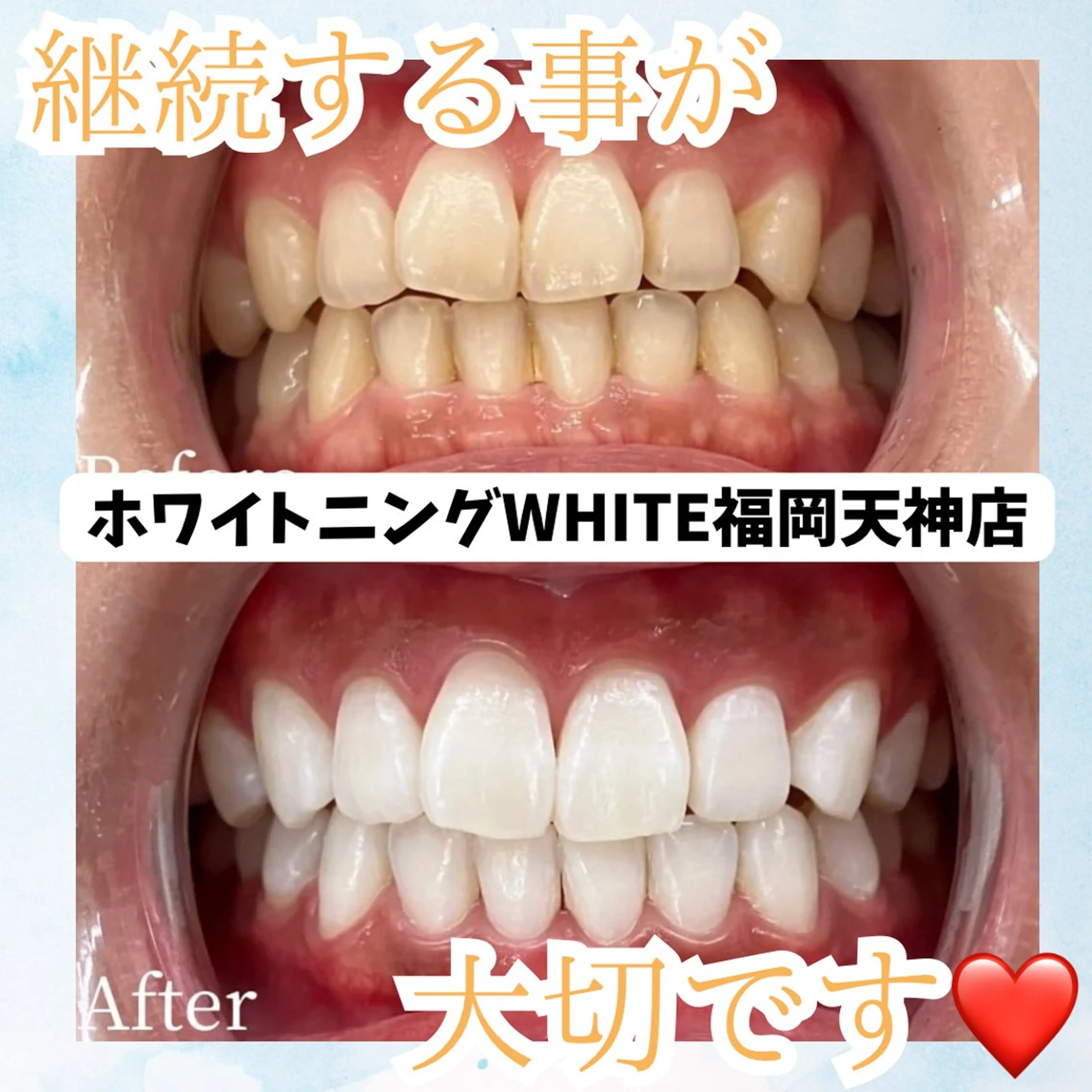 メンズ エステ リラク ホワイトニング専門店 WHITE天神店のエステ・リラクイメージ