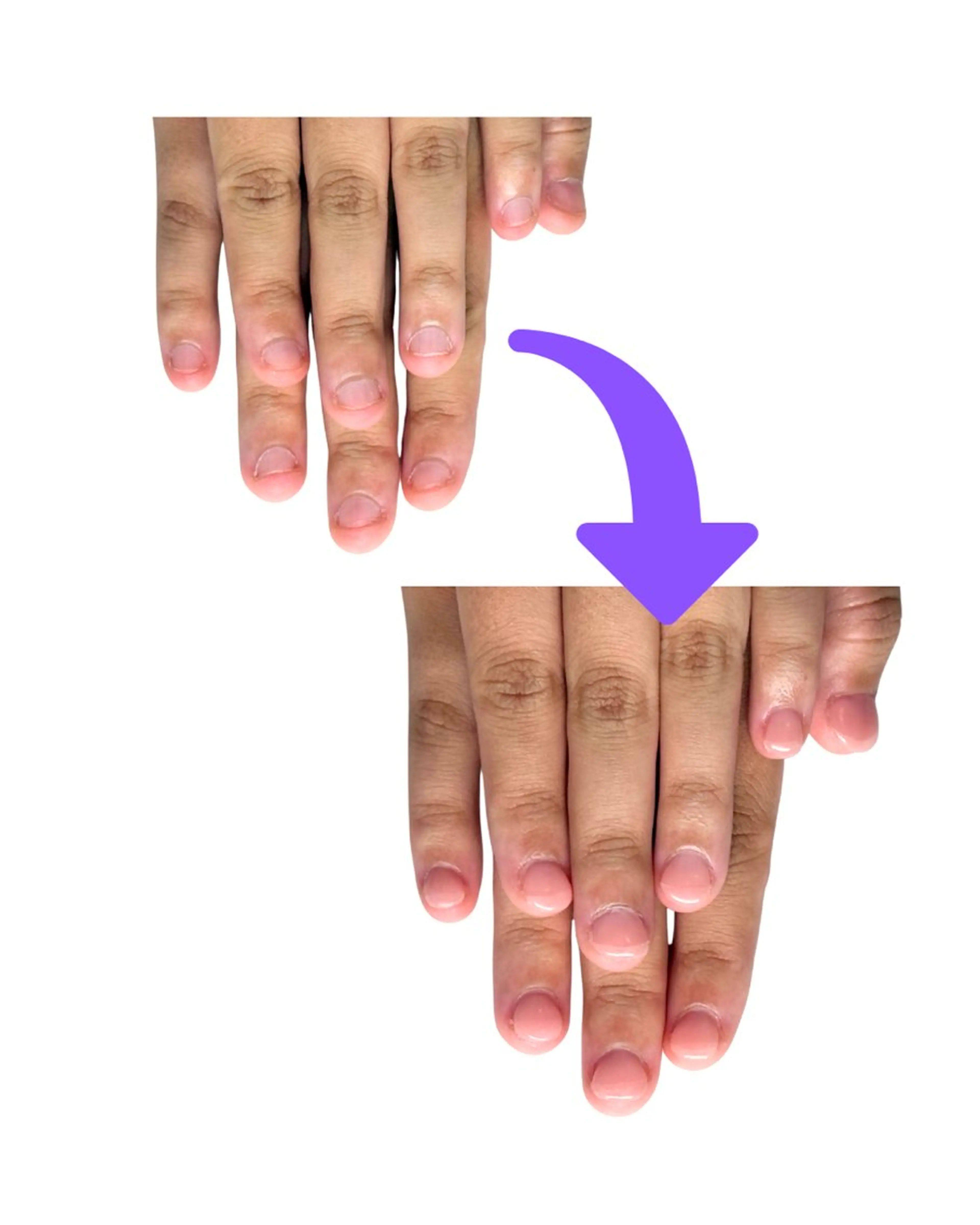 ネイル ワンカラーネイル 深爪矯正専門店ネイルサロンKUU所属・ネイルサロン KUUのネイルデザイン