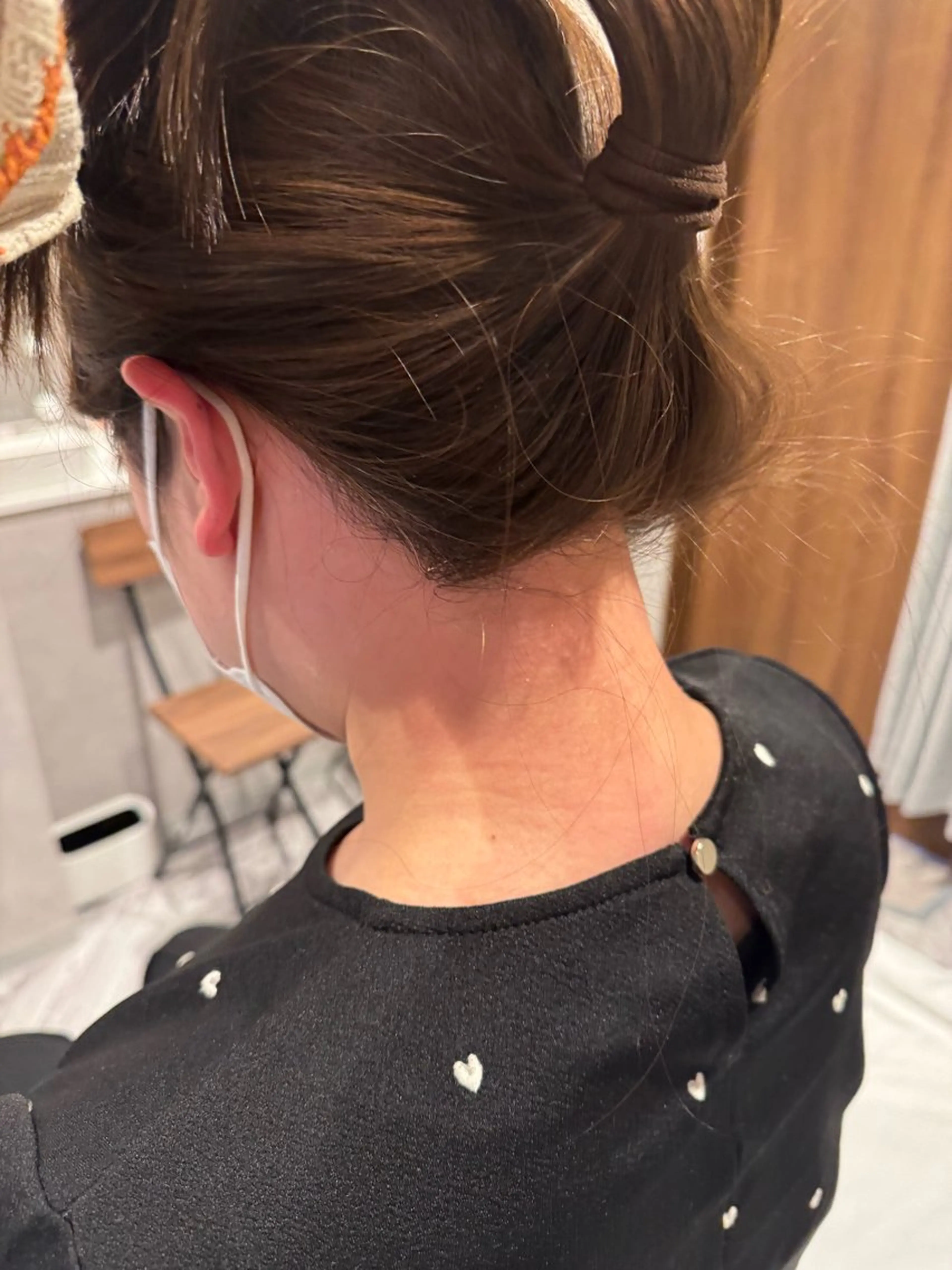 うなじワックス＋光脱毛の写真