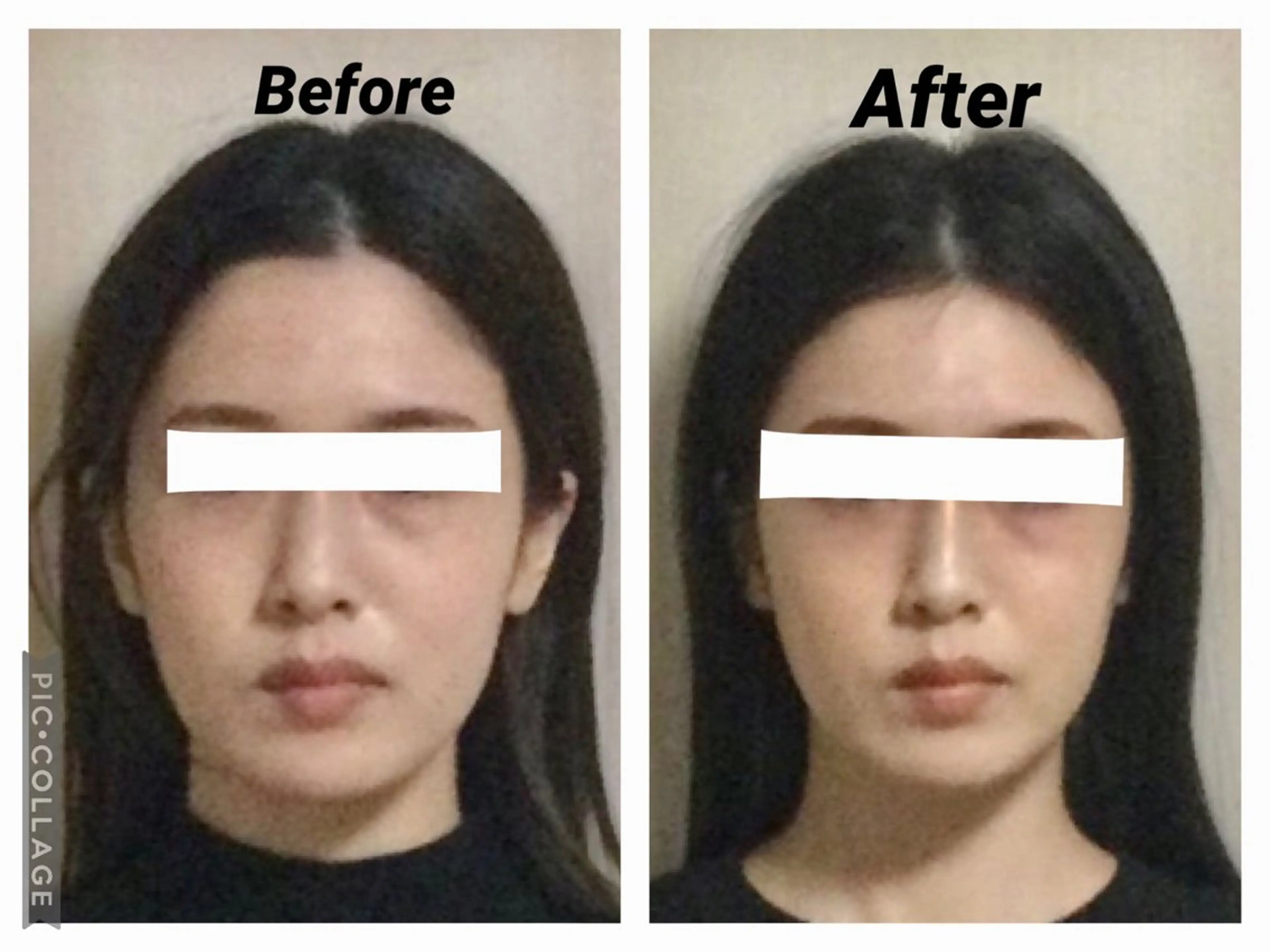 エステ リラク 小顔矯正Sho  FaceDesignのエステ・リラクイメージ