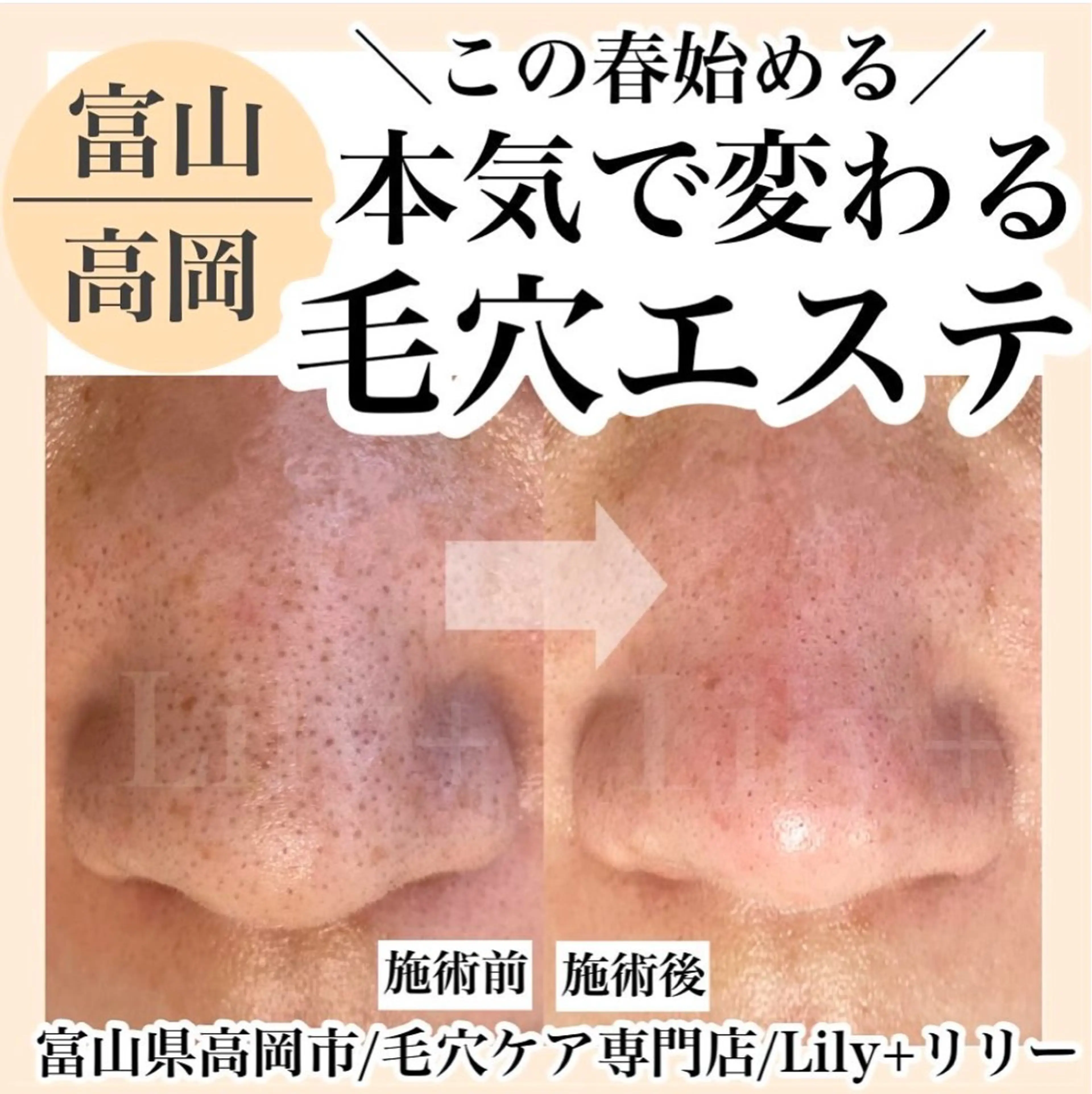 リリー yuriのエステ・リラクイメージ