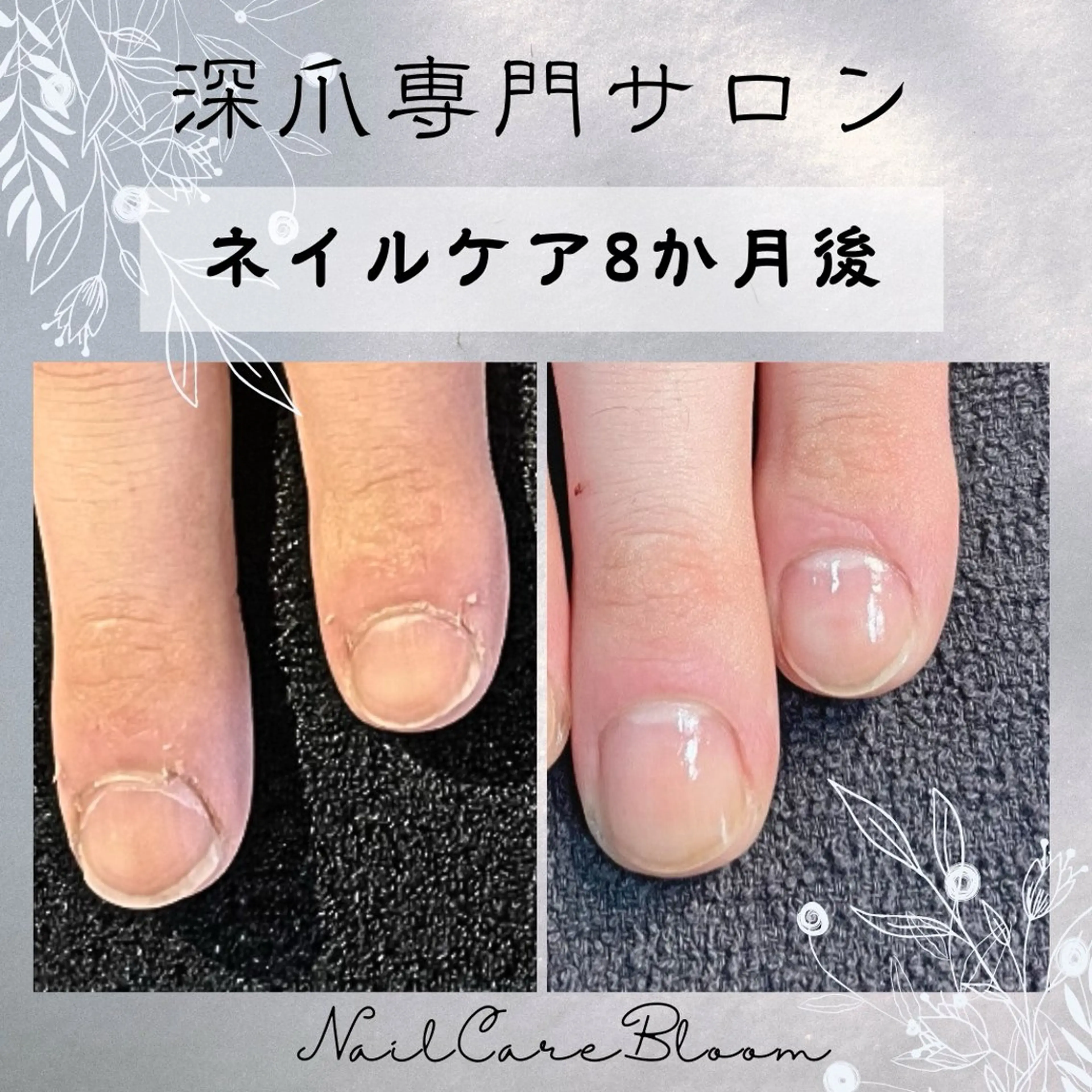 ネイル 深爪専門nail care bloomのネイルデザイン