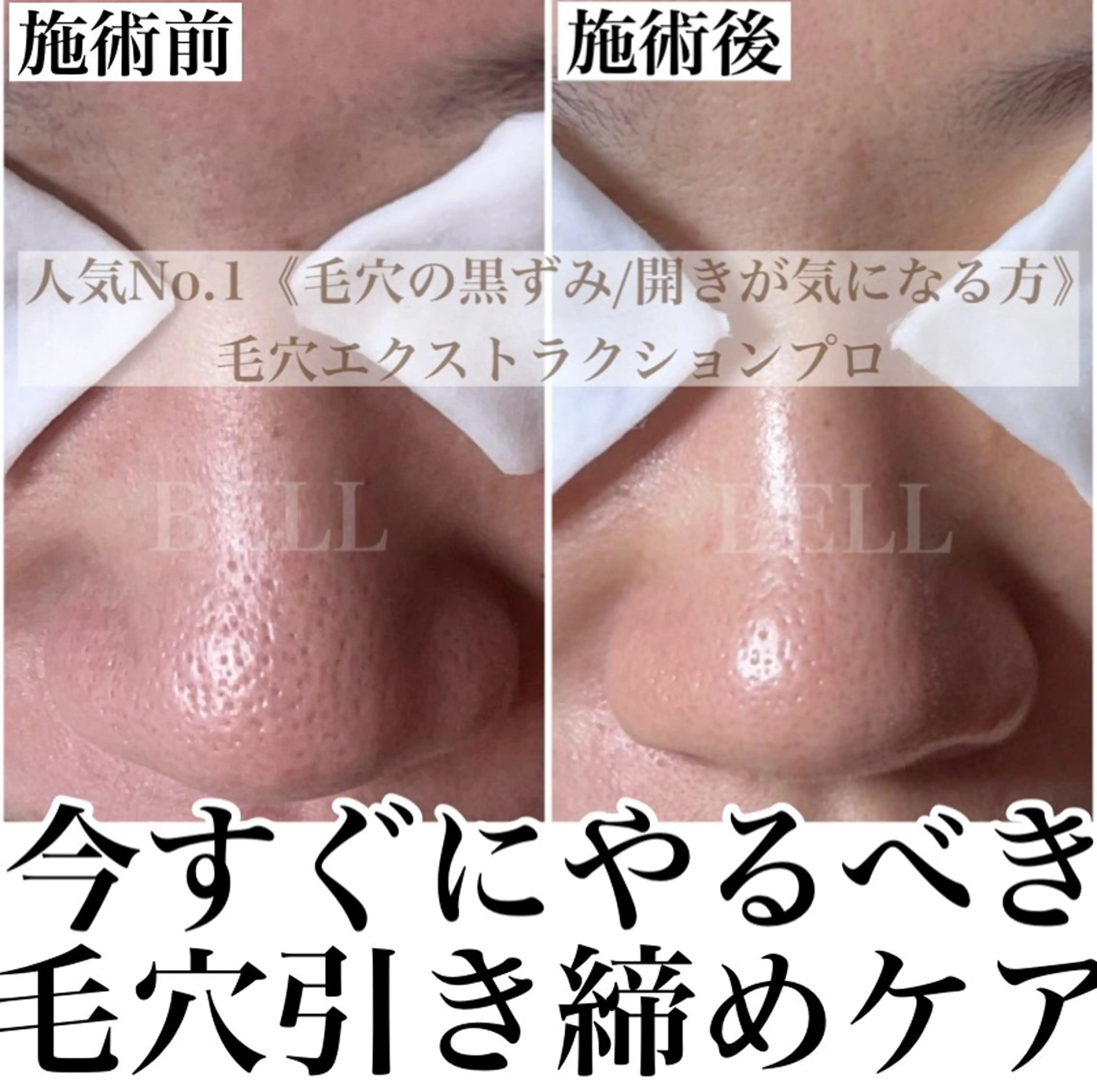 BEAUTY SALON BeLL所属・毛穴ケア専門店 BeLL ベルのエステ・リラクイメージ