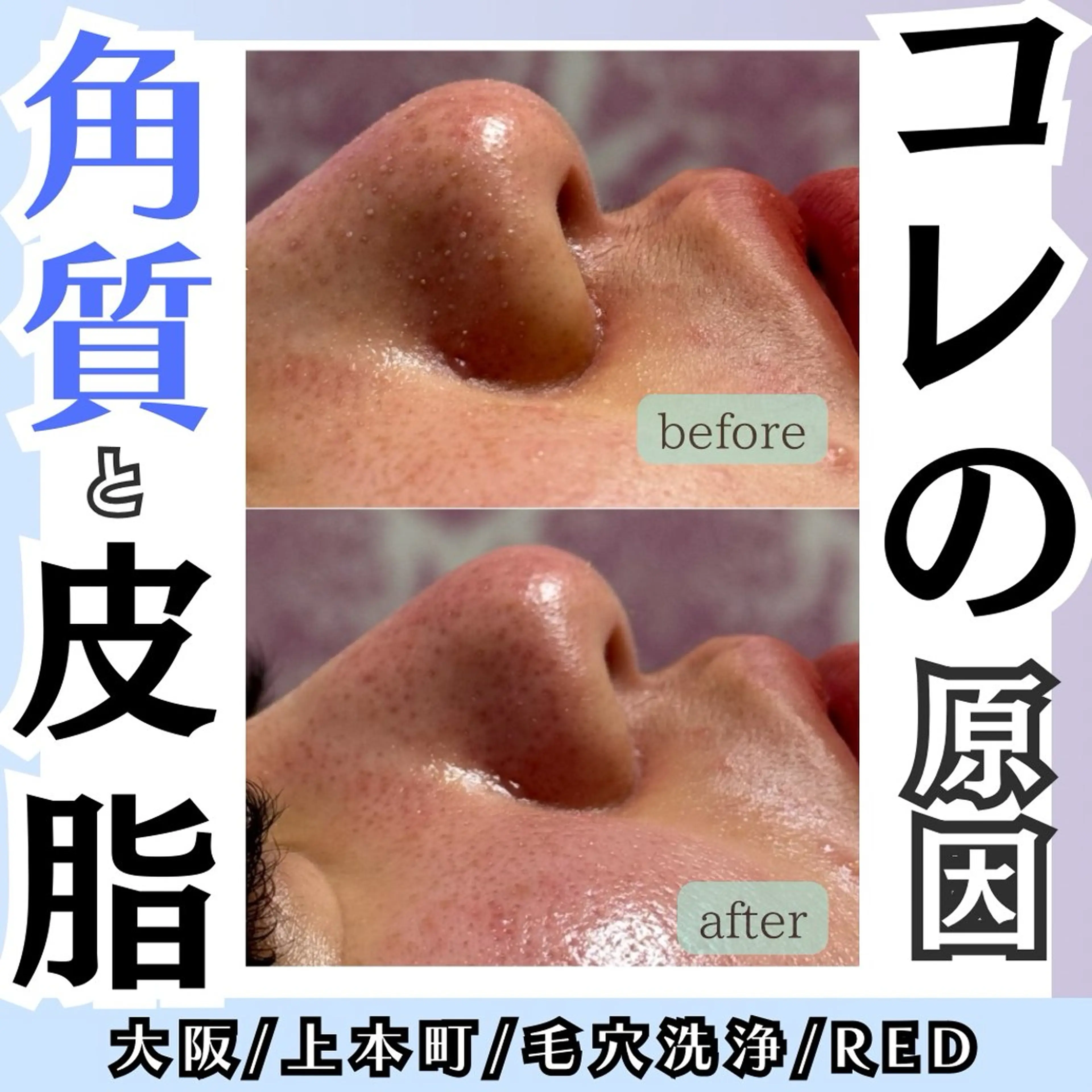 毛穴レス ハーブ& ワックス脱毛×光脱毛のエステ・リラクイメージ