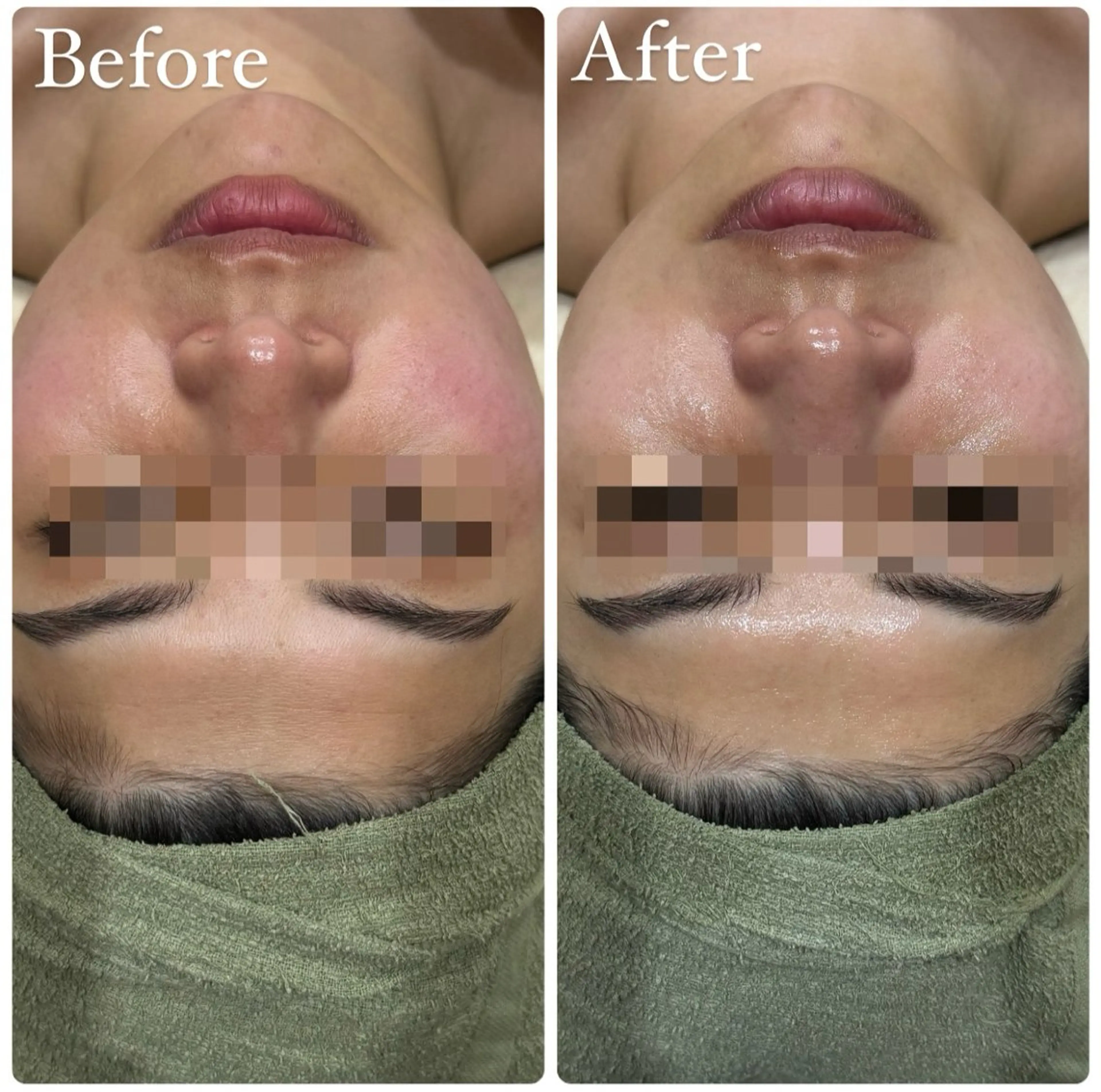 ハーブピーリング専門 muro.のエステ・リラクイメージ