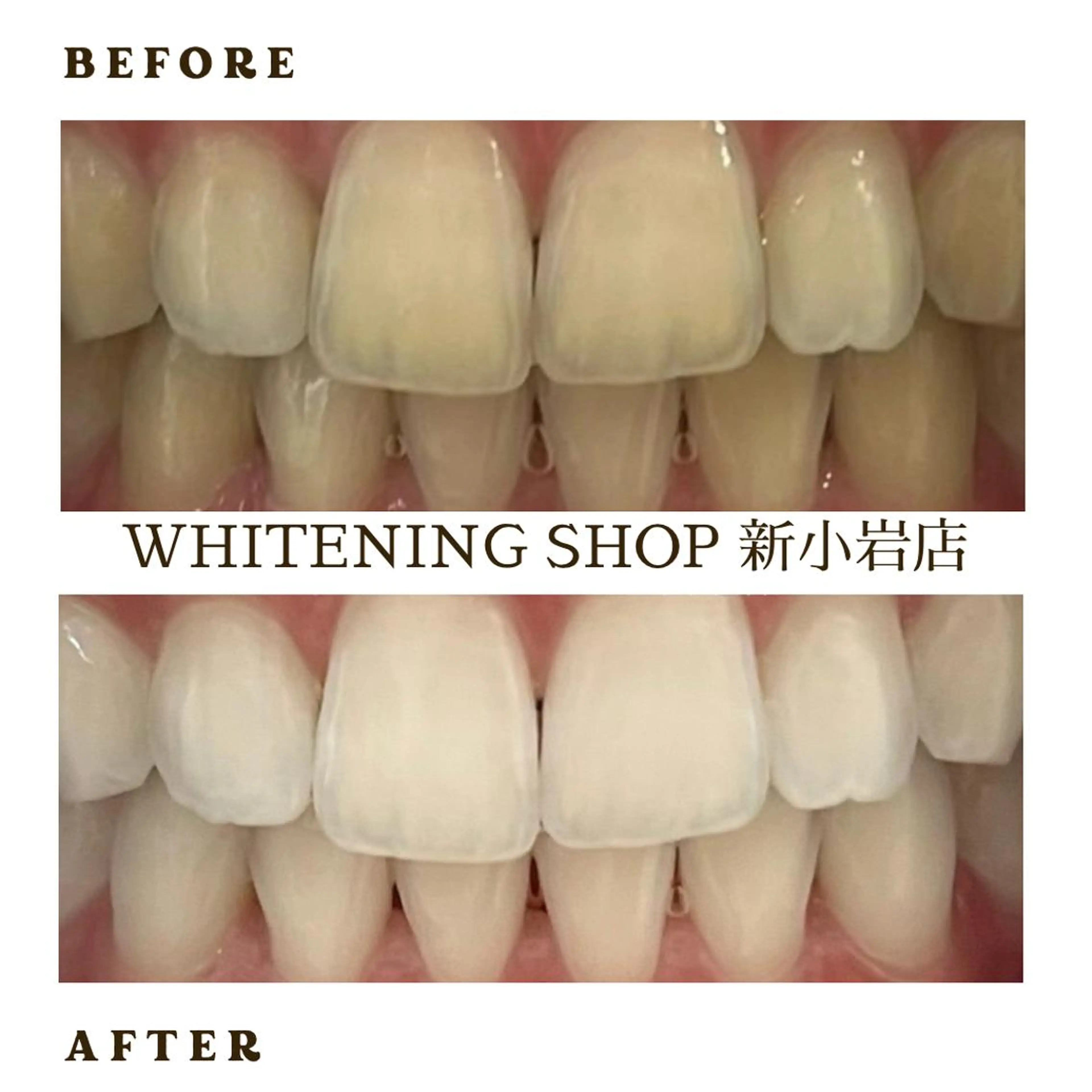 メンズ その他 ホワイトニング ショップ新小岩店のその他イメージ