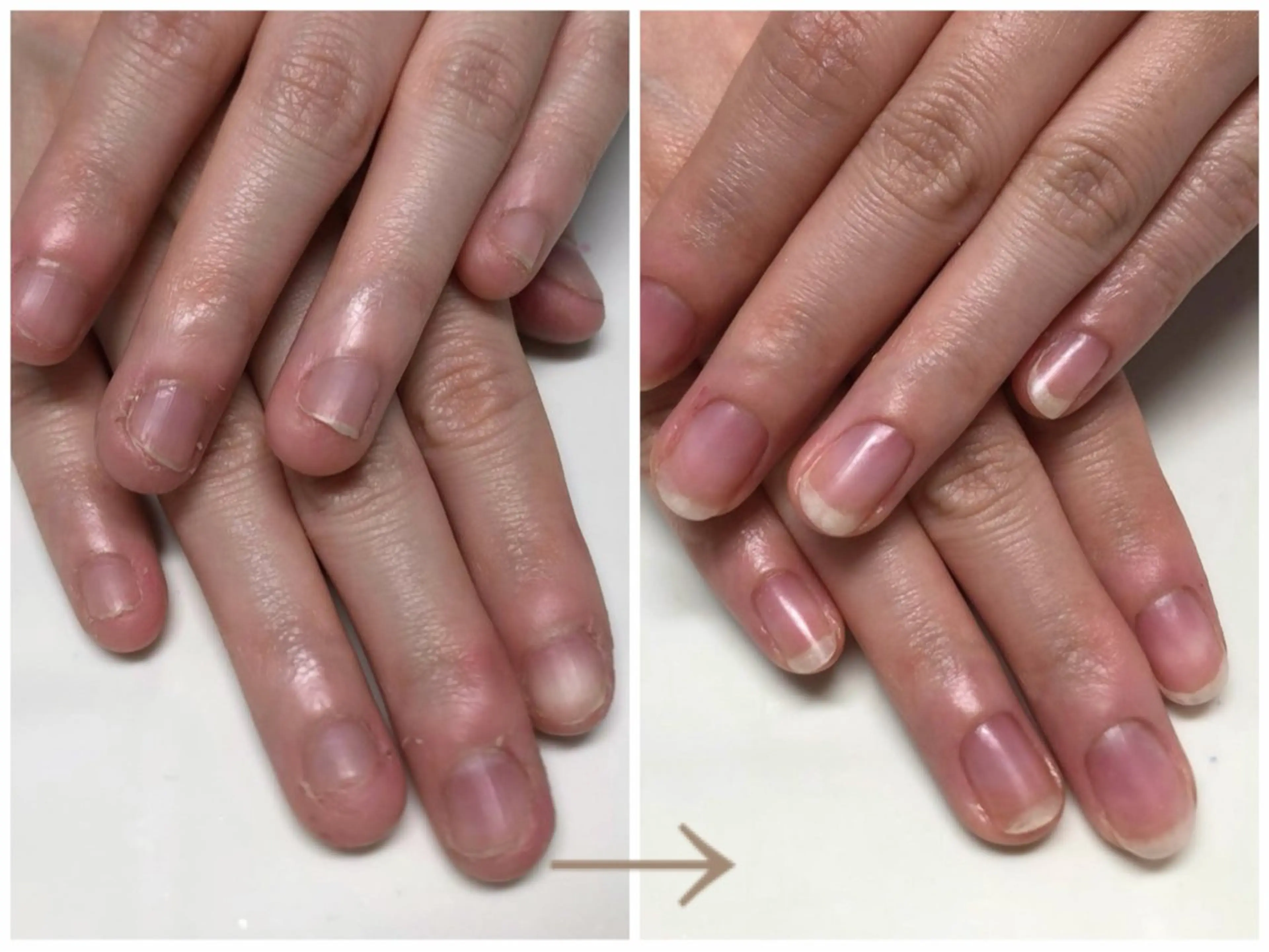 リピーター様用【ハンド自爪育成】ちび爪、まる爪さんも縦長な美爪を目指せるお試し１回　ワンカラーorクリア仕上げの写真