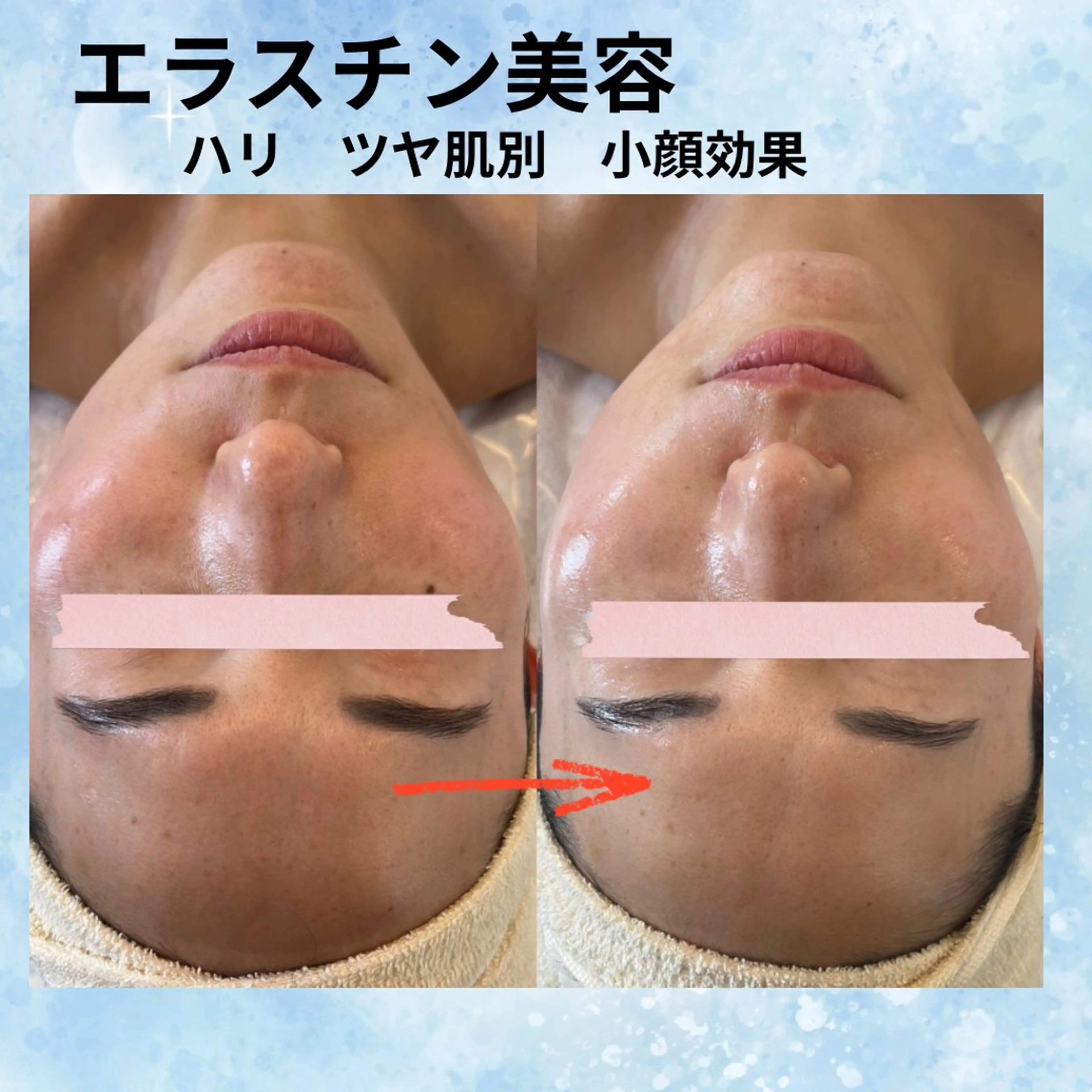 エステ beauty SalonRcoinのマツエク・マツパデザイン