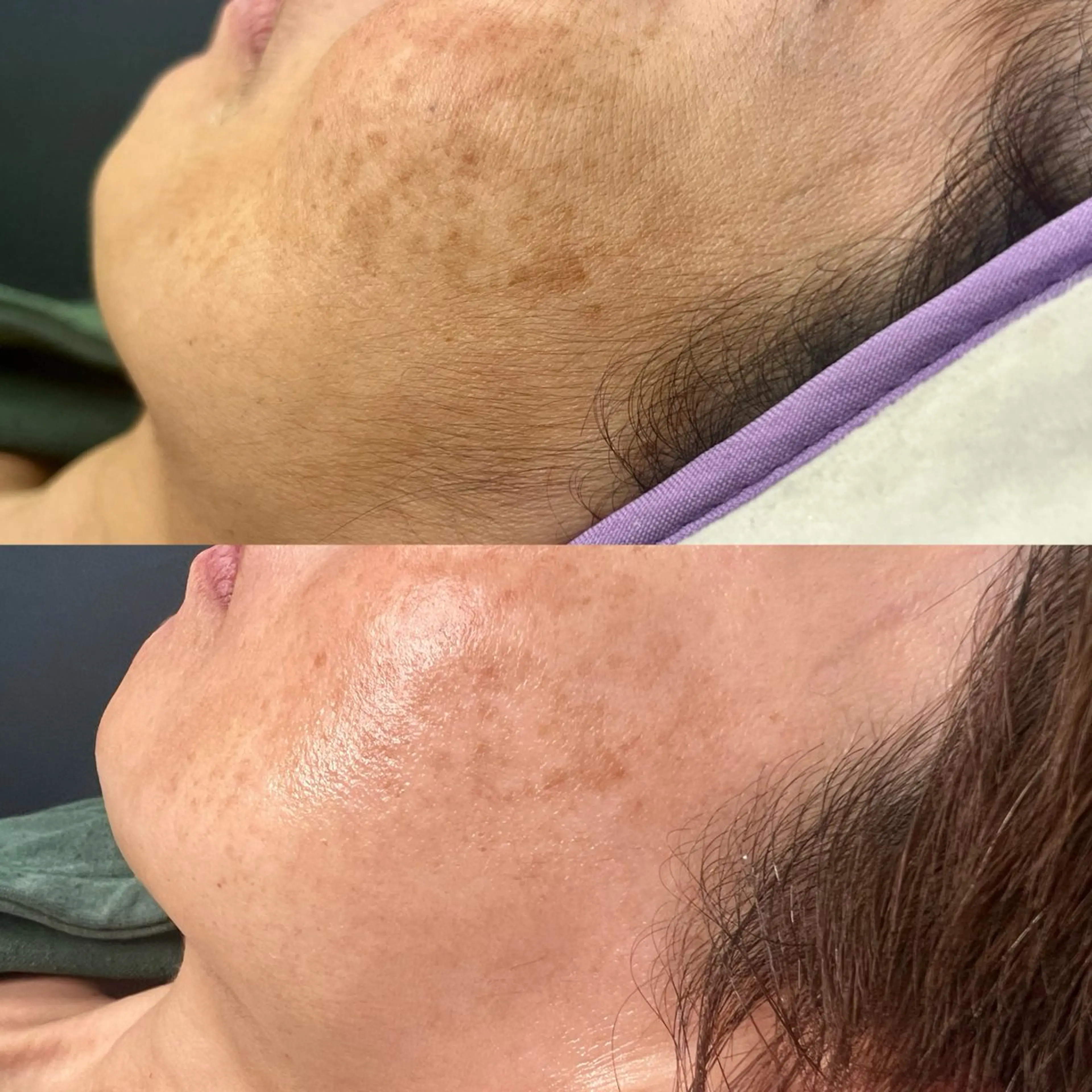 エステ curious所属・curious kurumiのマツエク・マツパデザイン