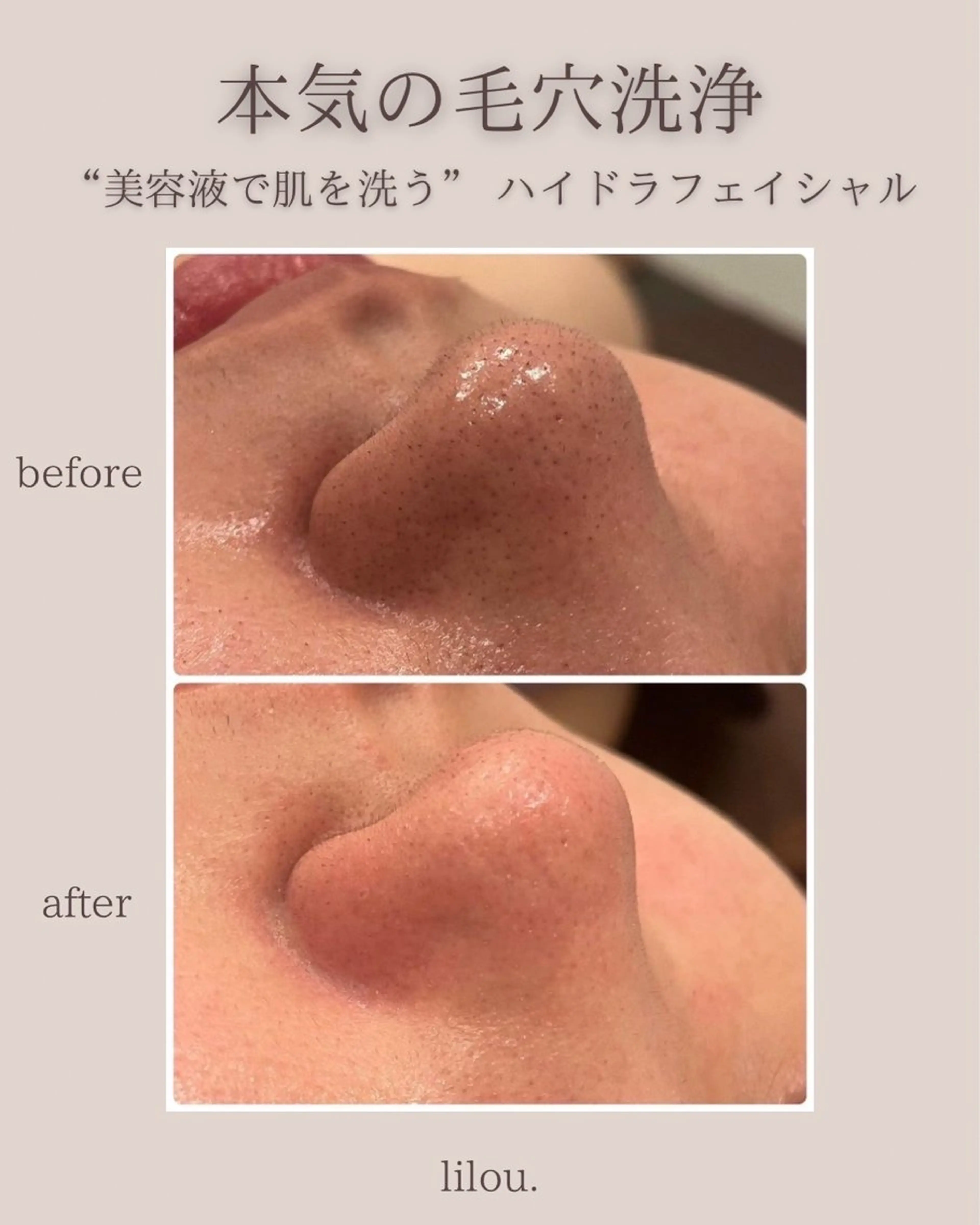 エステ hue.所属・LAND YUKAのエステ・リラクイメージ