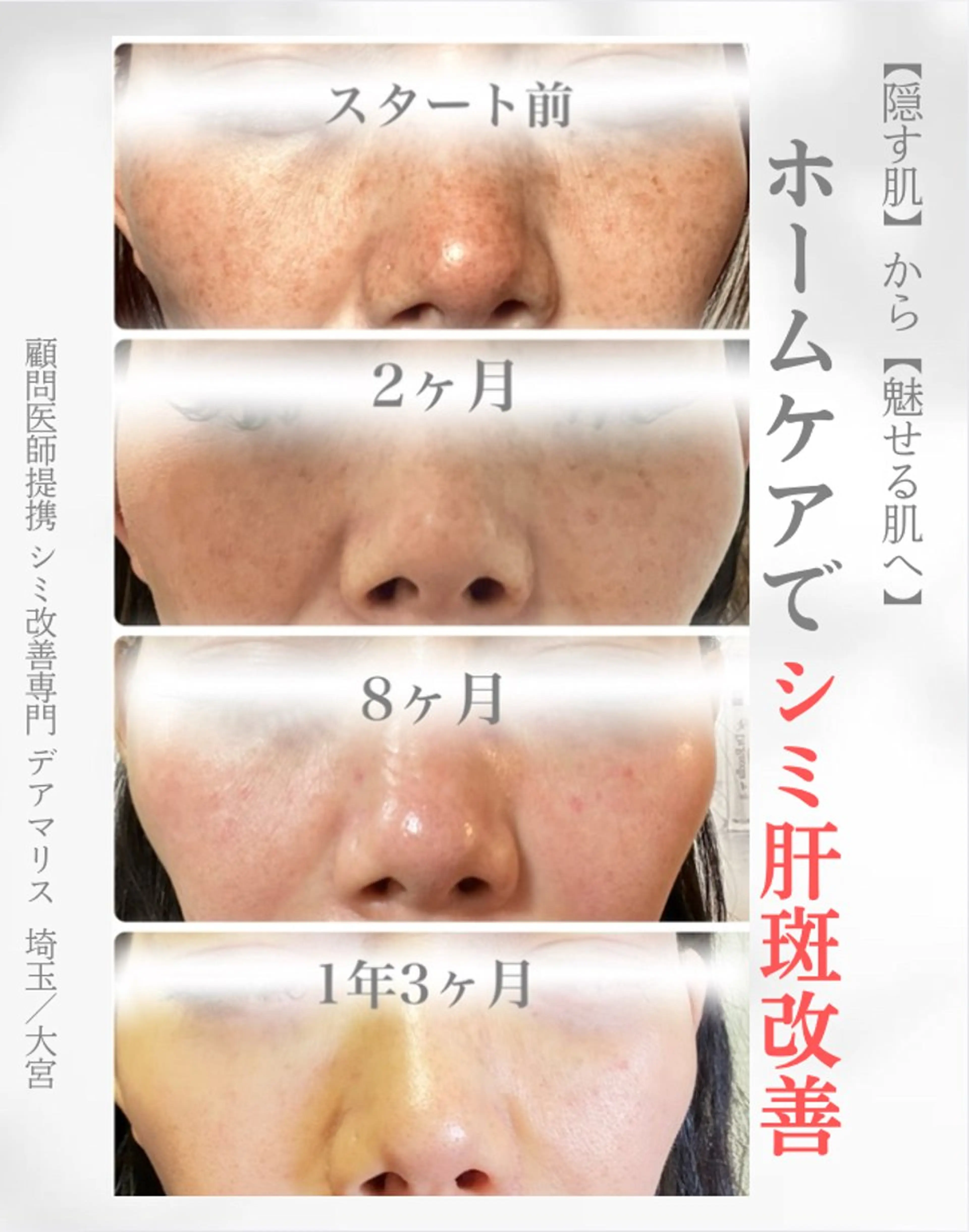 private salon  Dea_maris シュガーリング＆パーソナルボディケア所属・シミ改善・韓国肌管理 ボディメイク痩身のその他イメージ