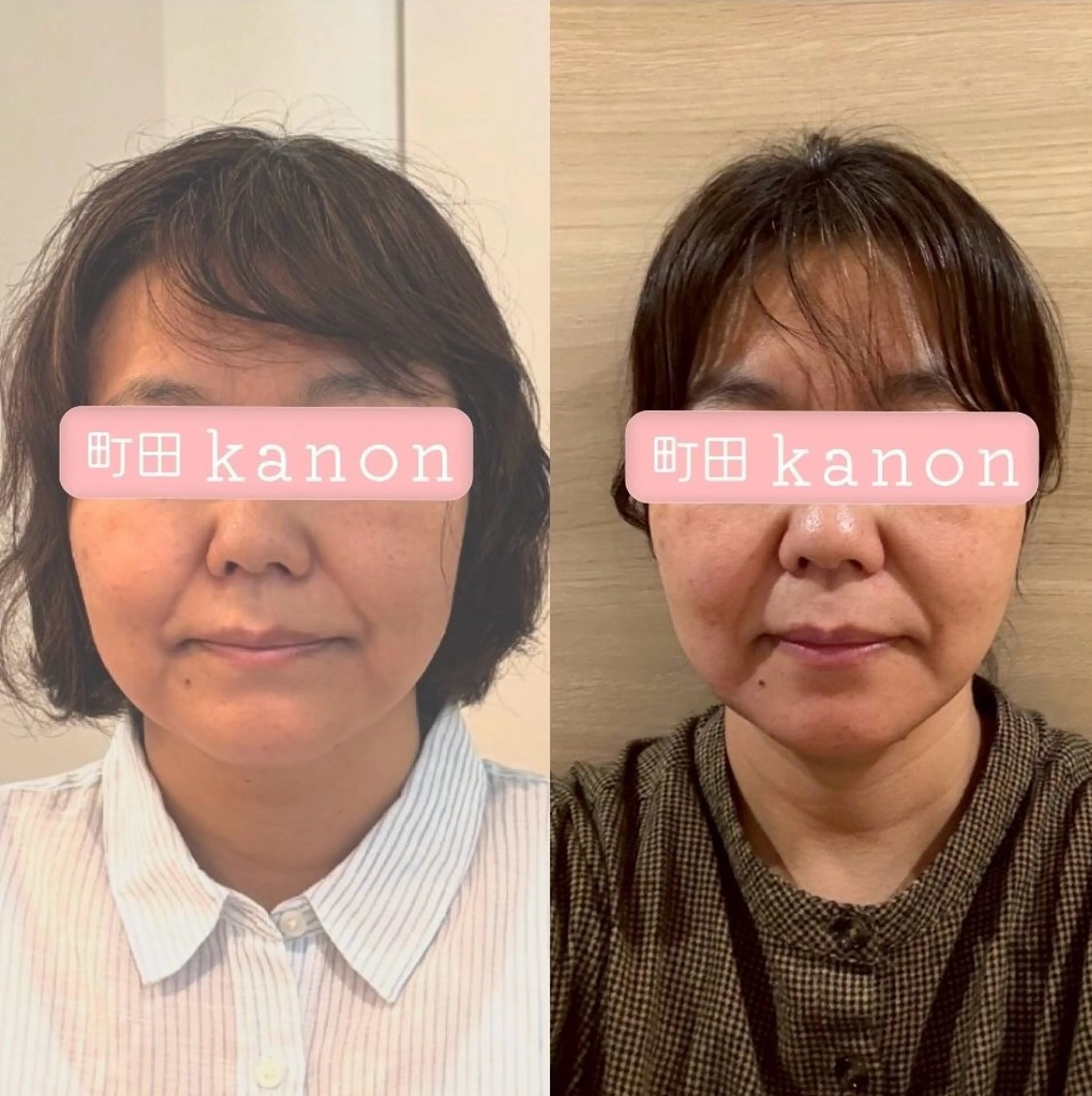 小顔矯正サロン町田 逸見智美のエステ・リラクイメージ