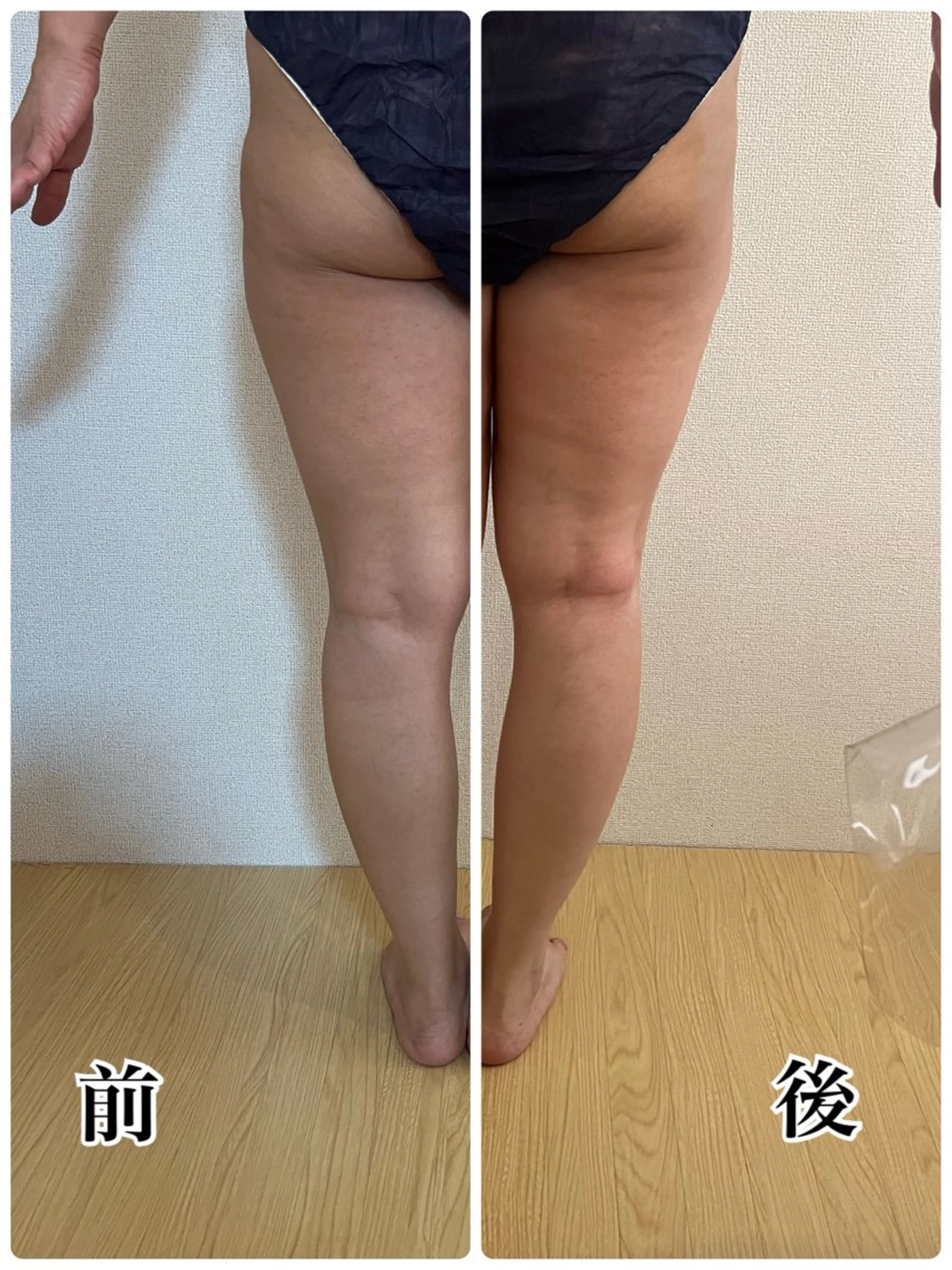 ❤︎MN❤︎ モンのエステ・リラクイメージ