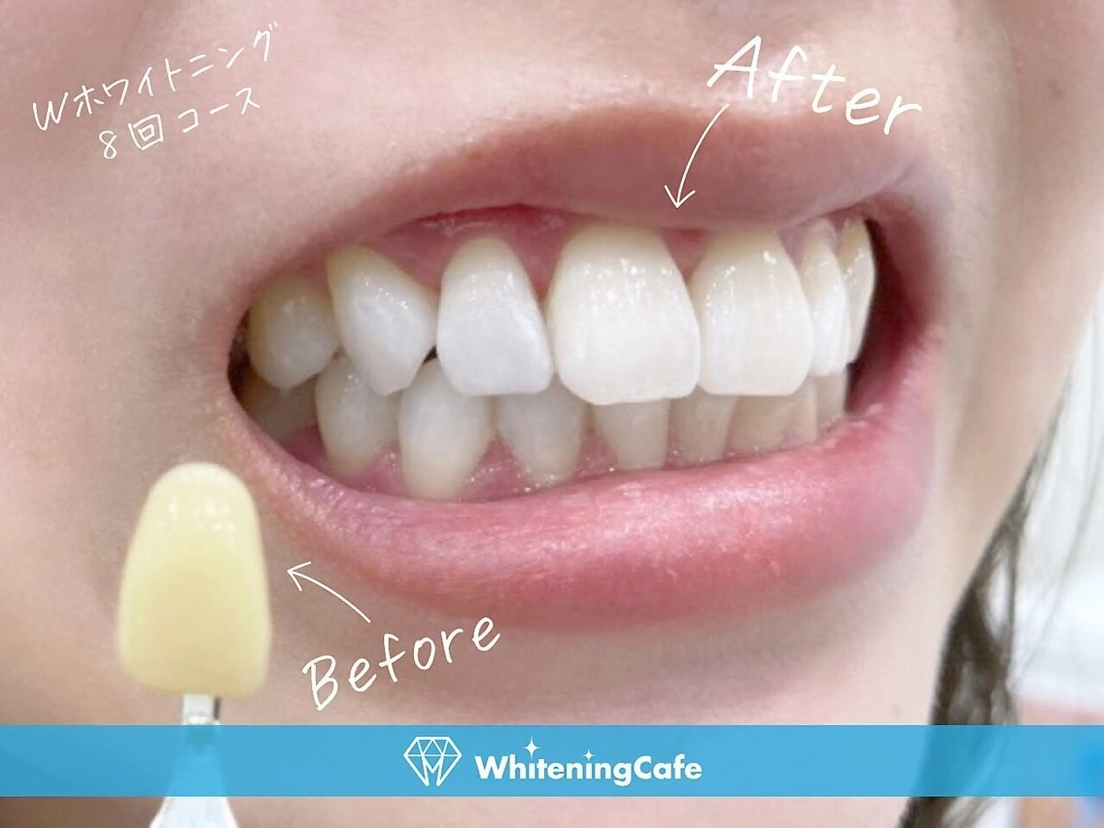 ホワイトニングカフェ中野店所属・ホワイトニングカフェ 中野店のその他イメージ