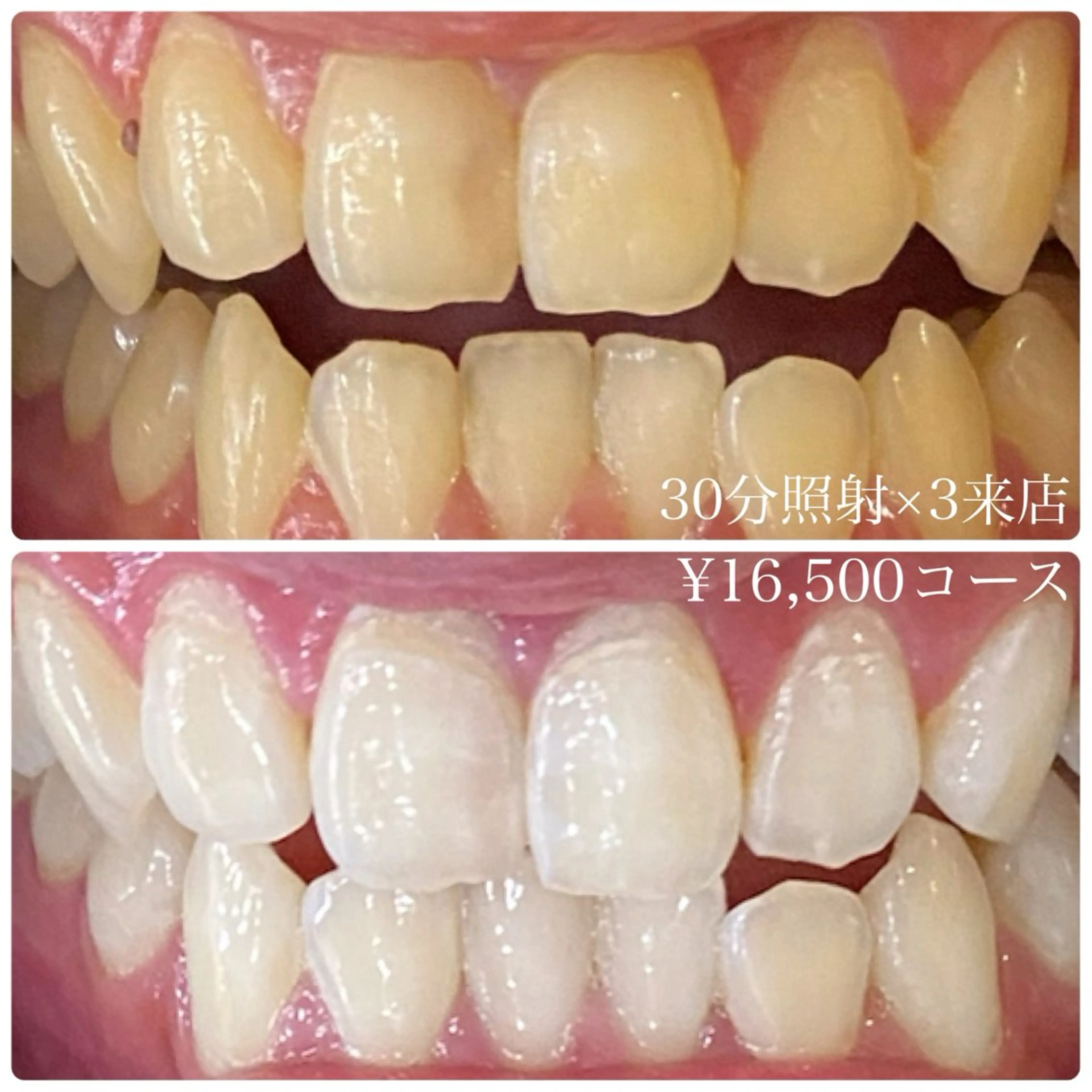 メンズ その他 ホワイトニングルーム　川崎店所属・ホワイトニング ルーム　川崎店のその他イメージ