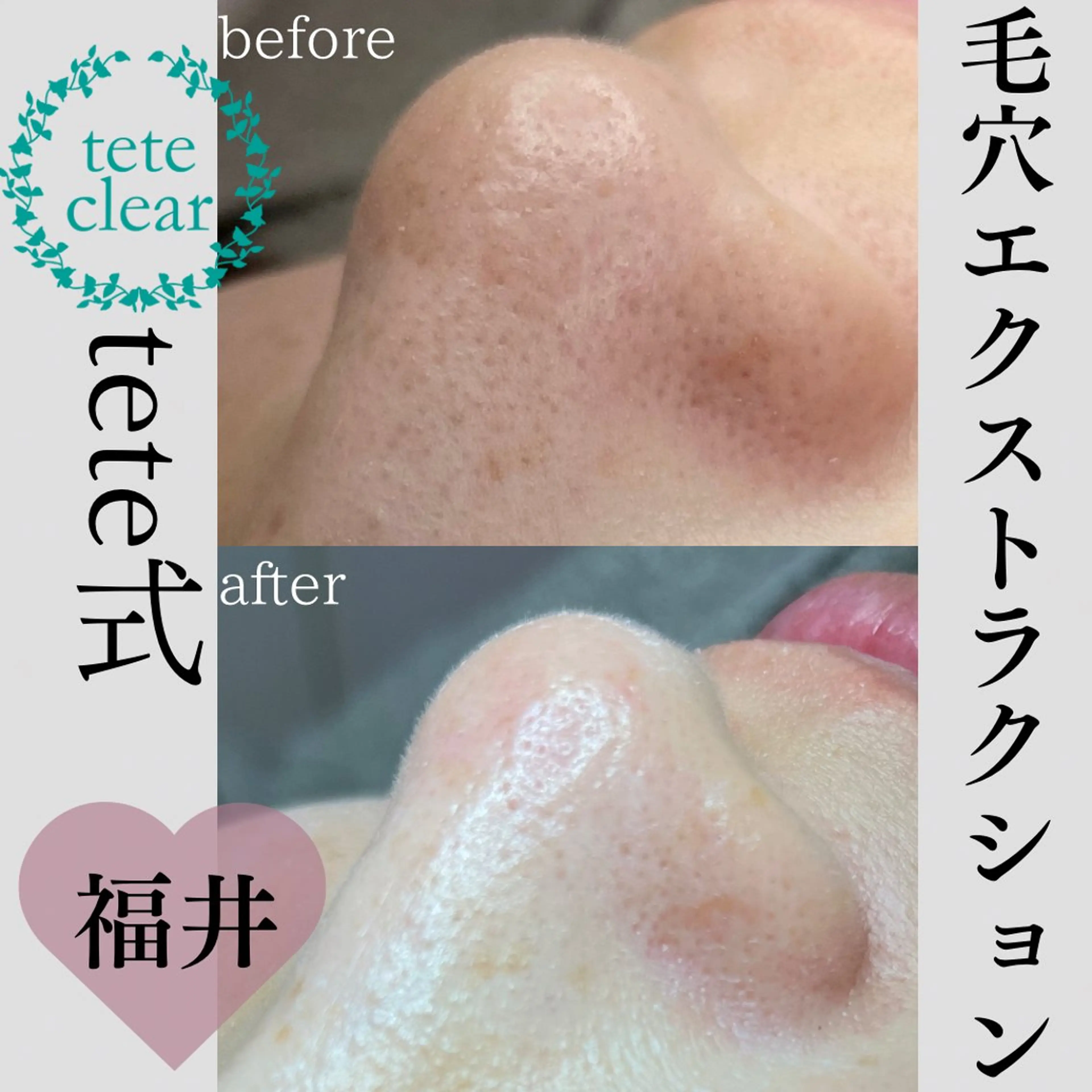 エステ リラク beautysalonW所属・beauty salonWのエステ・リラクイメージ