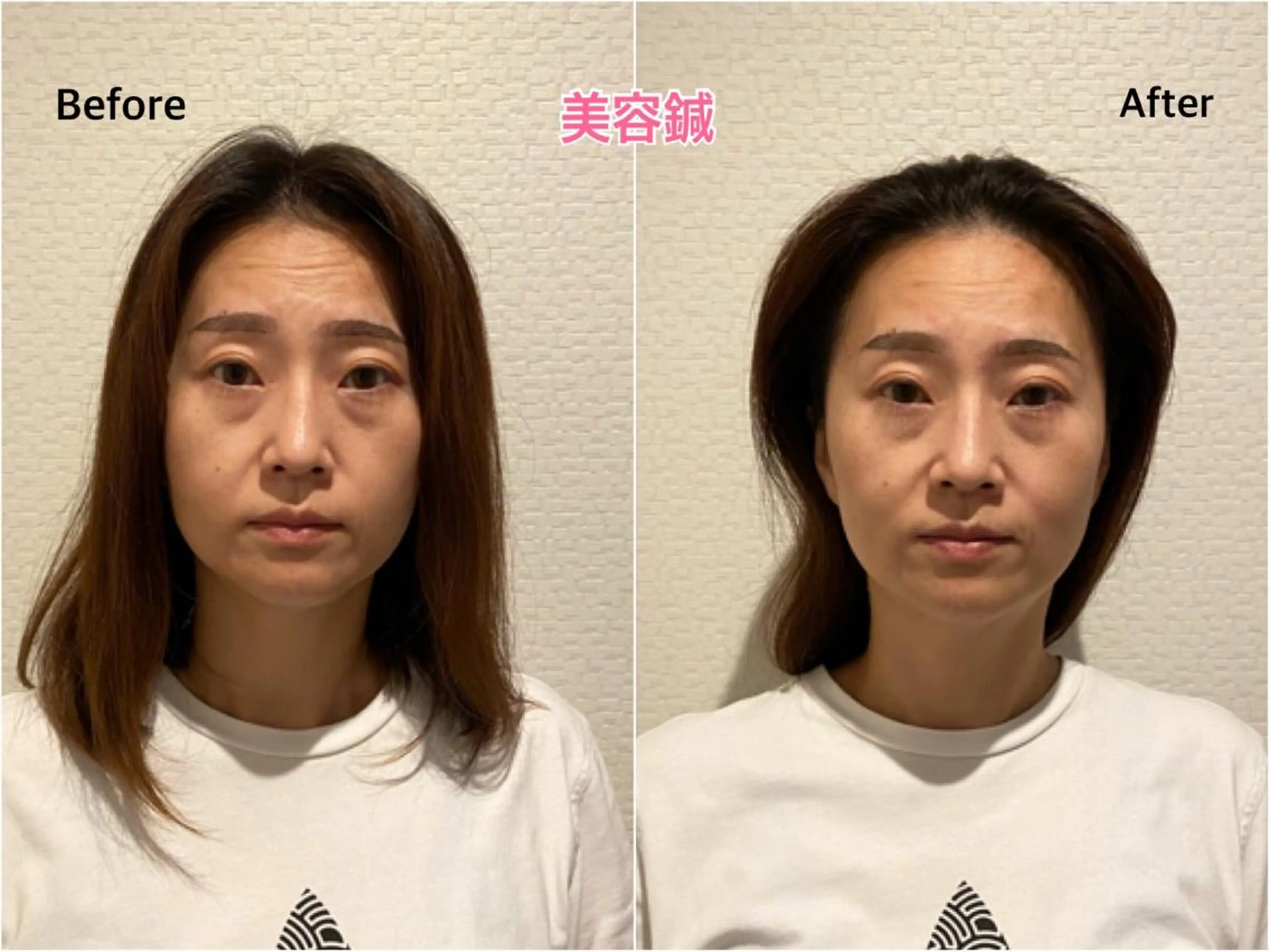 エステ チキバン美容鍼灸整体 サロン心斎橋店のエステ・リラクイメージ