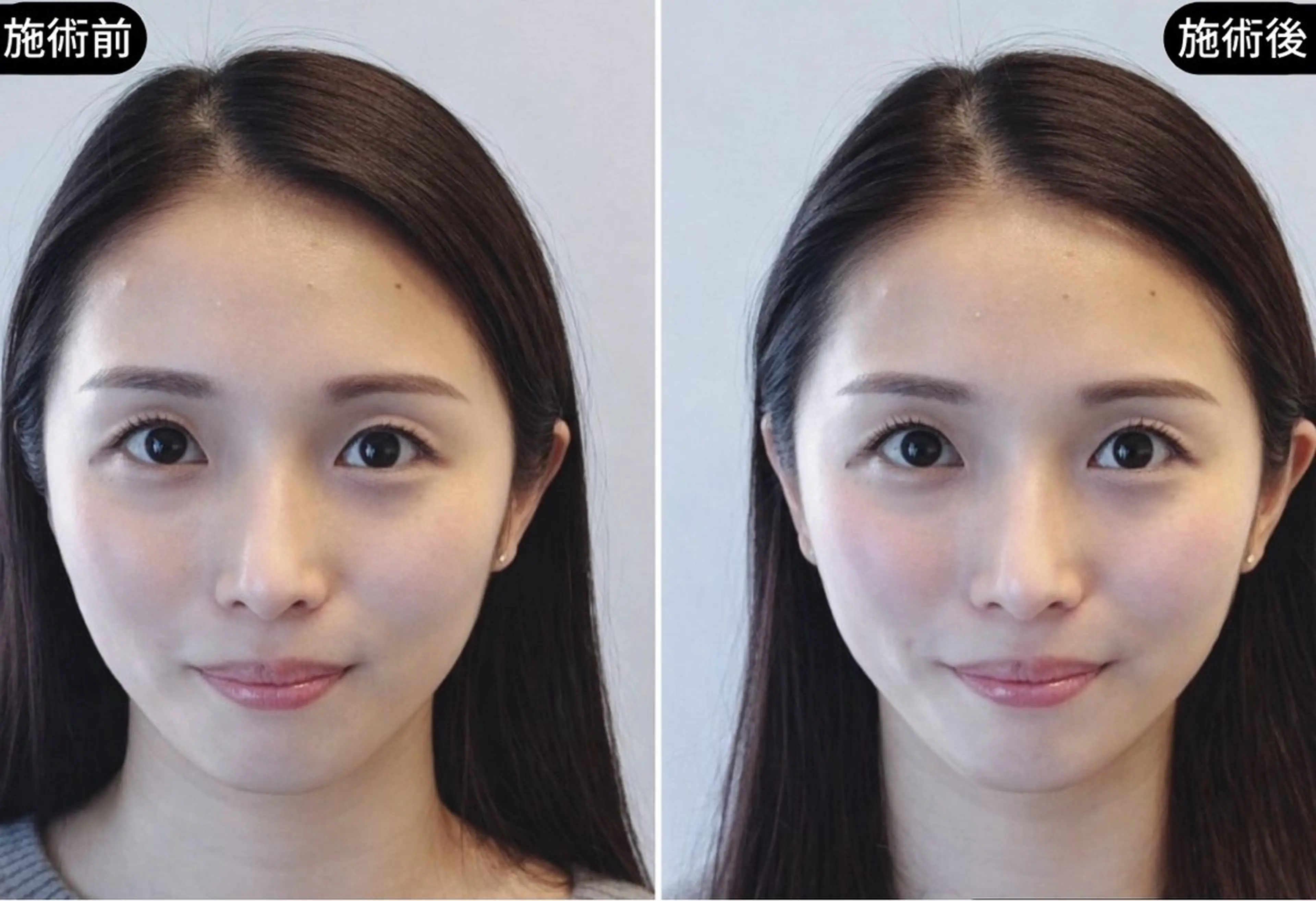 エステ リラク 小顔美容鍼専門サロン 渋谷YZのエステ・リラクイメージ