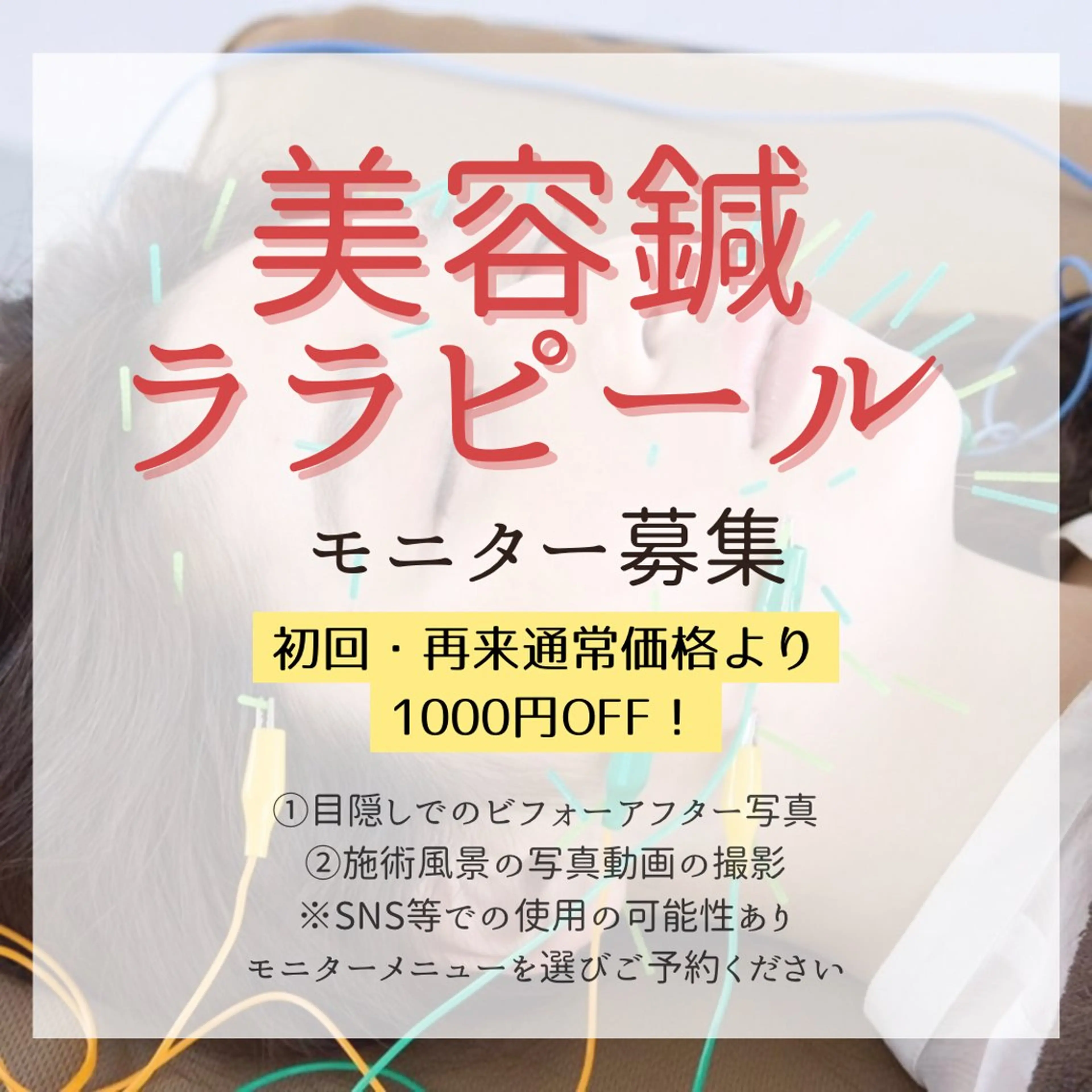 モニター📷美容鍼＋小顔マッサージ＋保湿仕上げの写真