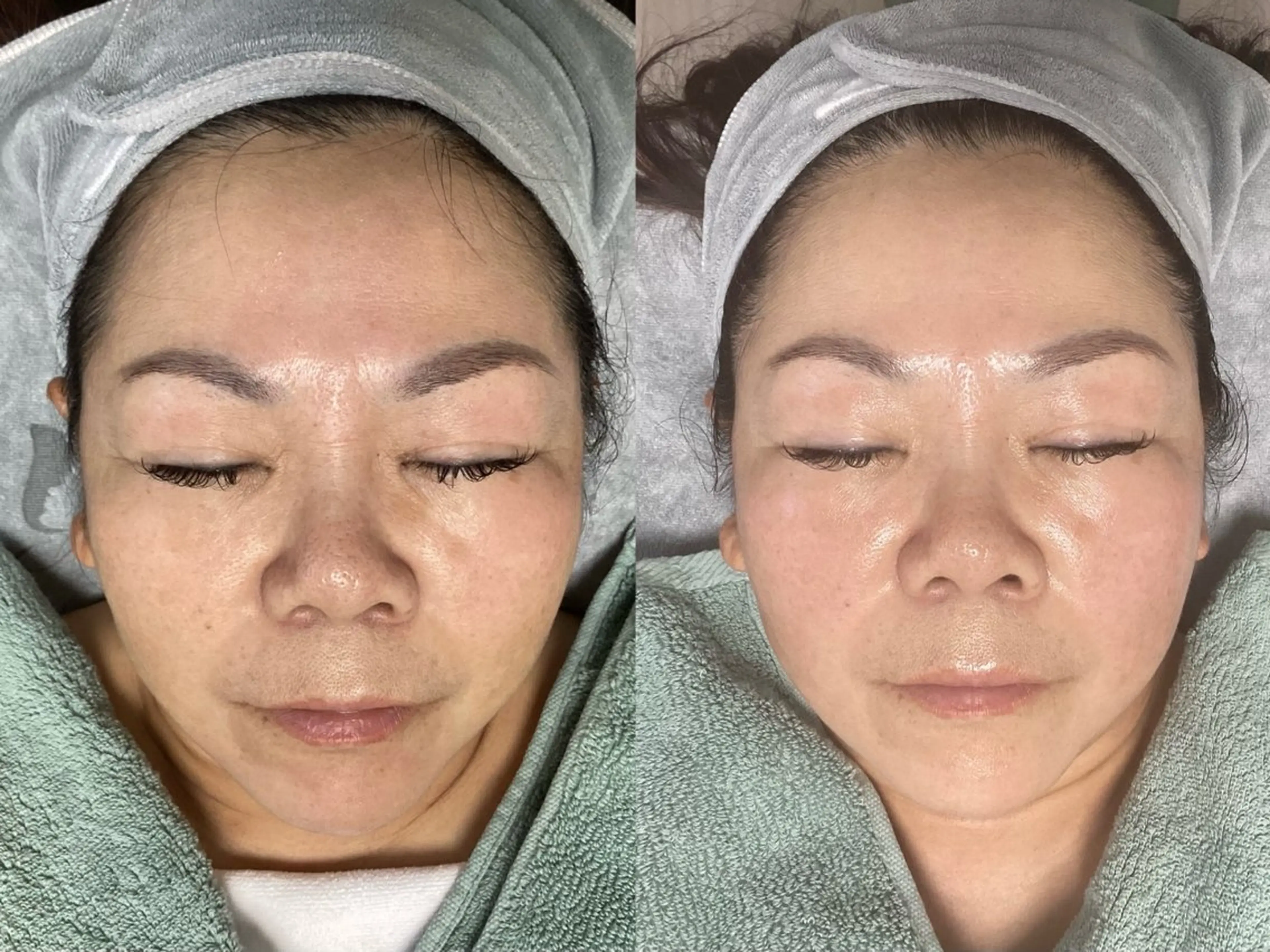 【ぷるぷる水光マイグロ二ドル】の写真